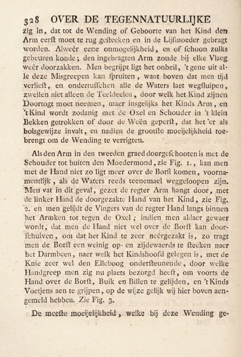 zig in, dat tot de Wending of Geboorte van het Kind dert Arm eerft moet te rug gefteeken en in de Lijfmoeder gebragt worden. Alwéér eene onmogelijkheid, en of fchoon zulks gebeuren konde; den ingebragceil Arm zoude bij elke Vlaeg wéér doorzakken. Men begrijpt ligt bet onheil, ’tgene uit al- le deze Misgreepen kan fpruiten , want boven dat men tijd verheft, en ondertuflchen alle de Waters laet wegduipen, zwellen niet alleen de Teeldeelen, door welk het Kind zijnen Doortogt moet neemen, maer insgelijks het Kinds Arm , en ’tKind wordt zodanig met de Oxel en Schouder in ’t klein Bekken getrokken of door de Ween geperft, dat het’er als bolsgewijze invalt, en nadien de grootfte moeijelijkheid toe- brengt om de Wending te verrigten. Als den Arm in den tweeden graed doorgefchooten is met de Schouder tot buiten den Moedermond, zie Fig. r., kan men met de Hand niet zo ligt meer over de Borft komen, voorna- mentlijk , als de Waters reeds teenemael weggeloopen zijn. Men vat in dit geval, gezet de regter Arm hangt door, met de linker Hand de doorgezakte Hand*van het Kind, zie Fig. *2. en men gelijdt de Vingers van de regter Hand langs binnen het Armken tot tegen de Oxel ,• indien men aldaer gewacr wordt, dat men de Hand niet wel over de Borft kan door- i . fchuiven, om dat het Kind te zeer neêrgezakt is, zo tragt men de Borft een weinig op- en zijdewaerds te fteeken naer het Darmbeen, naer welk het Kindshoofd gelegen is, met de Knie zeer wel den Elleboog onderfteunende, door welke Handgreep men zig nu plaets bezorgd heeft, om voorts de Hand over de Borft, Buik en Billen te gelijden, en ’t Kinds Voetjens aen te grijpen, op de wijze gelijk wij hier boven aen- gemeld hebben. Zie Fig. 3. De meefte moeijelijkheid, welke bij deze Wending ge-