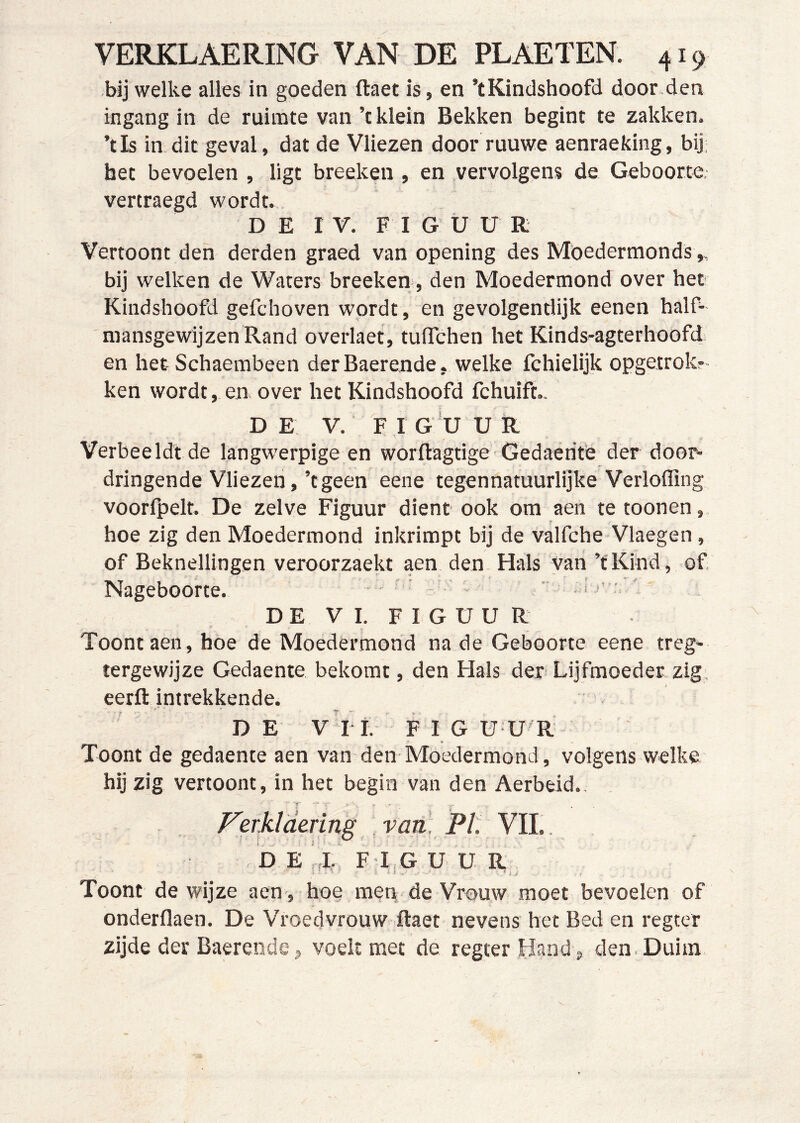 bij welke alles in goeden ftaet is, en ’tKindshoofd door.den ingang in de ruimte van ’c klein Bekken begint te zakken, ’tls in dit geval, dat de Vliezen door ruuwe aenraeking, bij het bevoelen , ligt breeken , en vervolgens de Geboorte, vertraegd wordt., DE IV. FIGUUR Vertoont den derden graed van opening des Mbedermonds,, bij welken de Waters breekeni, den Moedermond over het- Kindshoofd gefchoven wordt , en gevolgentlijk eenen half- mansgewijzenRand overlaet, tulTchen het Kinds-agterhoofd en het Schaembeen derBaerende, welke fchielijk opgetrok?- ken wordt, en over het Kindshoofd fchuift.. DE: V. F I g’u U R Verbeeldt de langwerpige en worftagtige Gedaerife der door» dringende Vliezen,’tgeen eene tegennatuurlijke Verlofflng voorfpelt. De zelve Figuur dient ook om aeii te toonen, hoe zig den Moedermond inkrimpt bij de valfche Vlaegen, of Beknellingen veroorzaekt aen den Hals van ’tKihd, of Nageboorte. ' > ’’ ’ DE VI. FIGUUR Toont aen, hoe de Moedermond na de Geboorte eene treg- tergewijze Gedaente bekomt, den Hals der Lijfmoeder zig- eerft intrekkende. DE vri. FIGUUR Toont de gedaente aen van den Moedermond, volgens welke hij zig vertoont, in het begin van den Aerbeid., Ferkidering van. PI. VIL. DE,J.. FIGUUR Toont de wijze aen, hoe men de Vrouw moet bevoelen of onderflaen. De Vroedvrouw ftaet nevens het Bed en regeer zijde der Baerende j voelt met de regterHand^ den. Duim