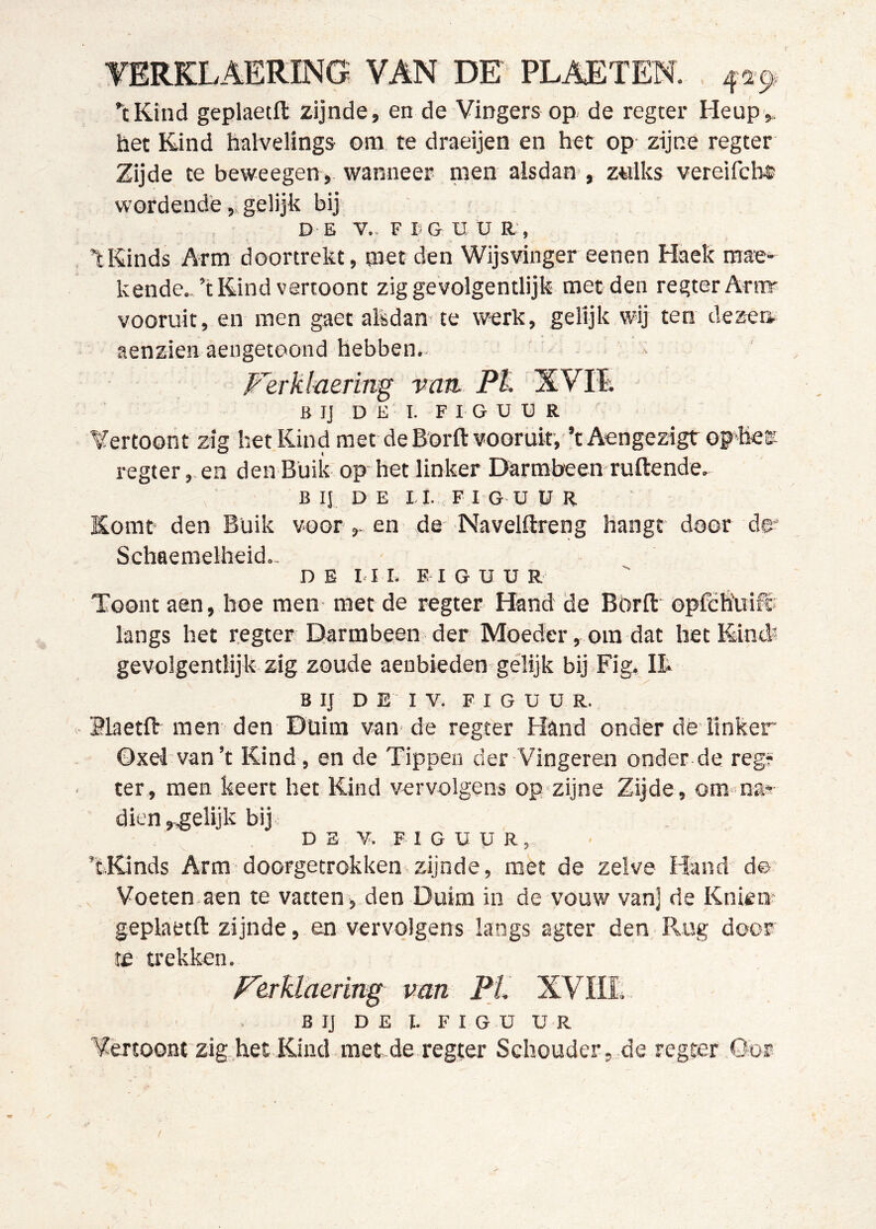 yERKLAERING VAN DE PLAETEN. 459, ^cKind geplaetft zijnde, en de Vingers op de regter Heupv. het Kind halvelings om te draeijen en het op zijne regter Zijde te beweegen , wanneer men alsdan , z«lks vereifche wordende, gelijk bij , D E V.. F B G U U R:, tKinds Arm doortrekt, met den Wijsvinger eenen Haek mae'- kende..’t Kind vertoont zig gevolgentlijk met den regter Arnv vooruit, en men gaetalsdamte werk, gelijk wij ten dezen, aenzien aengetoond hebben.. - Ferklaering vnn. Pt XVIï; B IJ DE I. FIGUUR Vertoont zig het Kind met de Borft vooruit, ’tAengezigt op hess regter,. en den Buik op Het linker Darmbeen ruftende. B IJ D E I I. F I G U U R Komt den Buik voor ,. en de- Navelftreng Hangt door do* Schaemelheid., DB 1.1 L F I G U U R Toont aen, hoe men met de regter Hand de Börft opfch'uifc langs het regter Darmbeen der Moeder, om dat het Kind? gevolgentlijk zig zoude aeubieden gélijk bij Fig, Ik B IJ D E IV. FIGUUR. Blaetft men den Duim vaiv de regter Hand onder dè linker Oxd van’t Kind, en de Tippen der Vingeren onder de reg? ter , men keert het Kind vervolgens op-zijne Zijde , om na^ dien ^.gelijk bij DE V. FIGUUR, ’tKinds Arm-doorgetrokken zijnde, met de zelve Hand d© , Voeten aen te vatten , den Duim in de vouw van] de Knien' geplaetft zijnde, en vervolgens langs agter den Rug door te trekken. FerMaermg van Pi. XVIIl B IJ DE I. F I G U U R Vertoont zig-,het Kind.met.de.regter Schouder,.de regter Oor