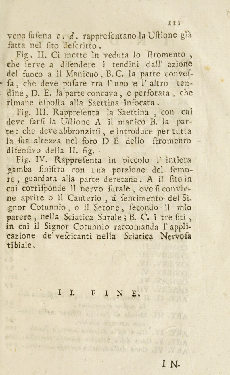 venn rufena c, d. rapprelentano laUftione già fatta nel fìto defcritto . Fig. li. Ci mette In veduta lo flromento , che ferve a difendere i tendini dall’ azione del fuoco a il xVlaniciio, B. C. la parte convef-  fa, che deve pofare tra l’uno e 1* altro ten- ■ dine,D. E. la parte concava, e perforata , che rimane efpofla alla Saettìna infocata. Fig. III. Rapprefenta la Saettina , con cui deve farli la Ulfione A il manico B. la par- te : che deve abbronzirli, e introduce per tutta là fua altezza nel foro D E dello Ilromento difensivo della IL fig. • Fig. IV. Rapprefenta in piccolo F intiera gamba finifira con una porzione del femo- re, guardata aMa parte deretana. A il fìto in cui corrifponde il nervo furale, ove fi convie- ne aprire o il Cauterio , à fentìmento del Si- gnor Cotunnio , o il Setone, fecondo-il mio parere , nella Sciatica Surale ; B. C. i tre fìti , in cui il Signor Cotunnio raccomanda F appli- cazione de’vefcicanti nella Sciatica Nervofa tibiale. I L FINE. I N-