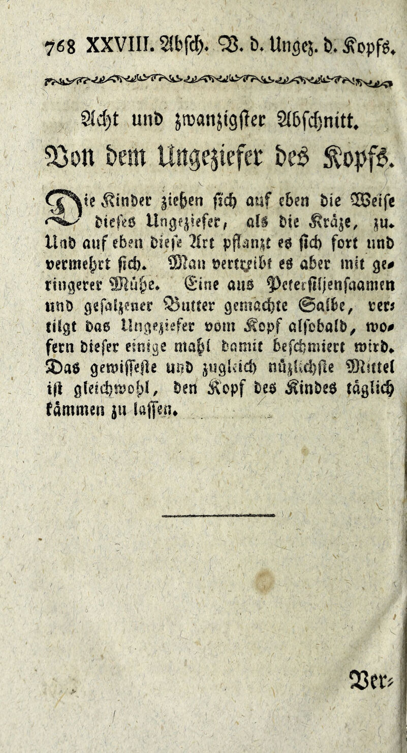 7^68 XXVIII. b. Ungej. b. 8fd)t mtb jroanjigllec Sibfc^nitt ?öon bem Uitge^iefet beé ^\te i^inDer sieben fjcb auf eben bic CSBetfc btefes llngesiefec, aU bie ^räje, ju. llnö auf eben biefe 2(rt pjl^nst es fid) fort unö uecKiebrt Cßlau ocrfyibe eö abec mit ge# tingerer ®übc. Sine aus ^eterfiiienfaamen unö gefallener Q5Hfter gemalte ©alBe, tere tilgt bas l!nge|sefec »om ^^opf ßlfcbalb^ tt»o# fern btefer einige ntabl bamit befd?miert wirb* 5DaS gemijfefle URb jugldcb nö|li(bjle 5)Ziftel ijt glelcbtöof)!, ben Stopf beö Ätnbeö tdglicb (ammen jii laffea*