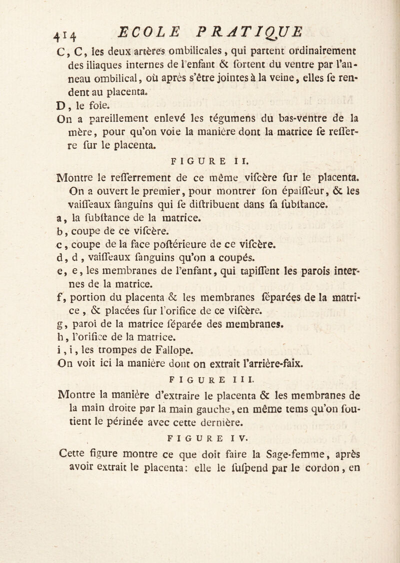 C, C, les deux artères ombilicales, qui partent ordinairement des iliaques internes de l'enfant & fortent du ventre par l’an- neau ombilical, où après s’être jointes à la veine, elles fe ren- dent au placenta. D, le foie. On a pareillement enlevé les tégumens du bas-ventre de la mère, pour qu’on voie la manière dont la matrice fe reffer- re fur le placenta. F I G U R E I I. Montre le reflerrement de ce même vifcère fur le placenta. On a ouvert le premier, pour montrer fon épaifleur, & les vaiiTeaux fanguins qui fe diftribuent dans fa fubltance. . a, la fubltance de la matrice. b, coupe de ce vifcère. c, coupe de la face poftérieure de ce vifcère. d, d , vaifleaux fanguins qu’on a coupés. e, e, les membranes de l’enfant, qui tapiflent les parois inter- nes de la matrice. f, portion du placenta & les membranes féparées de la matri- ce , & placées fur forifice de ce vilcère. g, paroi de la matrice féparée des membranes. h, l’orifice de la matrice. i, i, les trompes de Fallope. On voit ici la manière dont on extrait l’arrière-faix. F I G U R E I I I. Montre la manière d’extraire le placenta & les membranes de la main droite par la main gauche, en même tems qu’on fou- tient le périnée avec cette dernière. FIGURE IV. Cette figure montre ce que doit faire la Sage-femme, après avoir extrait le placenta : elle le fulpend par le cordon, en