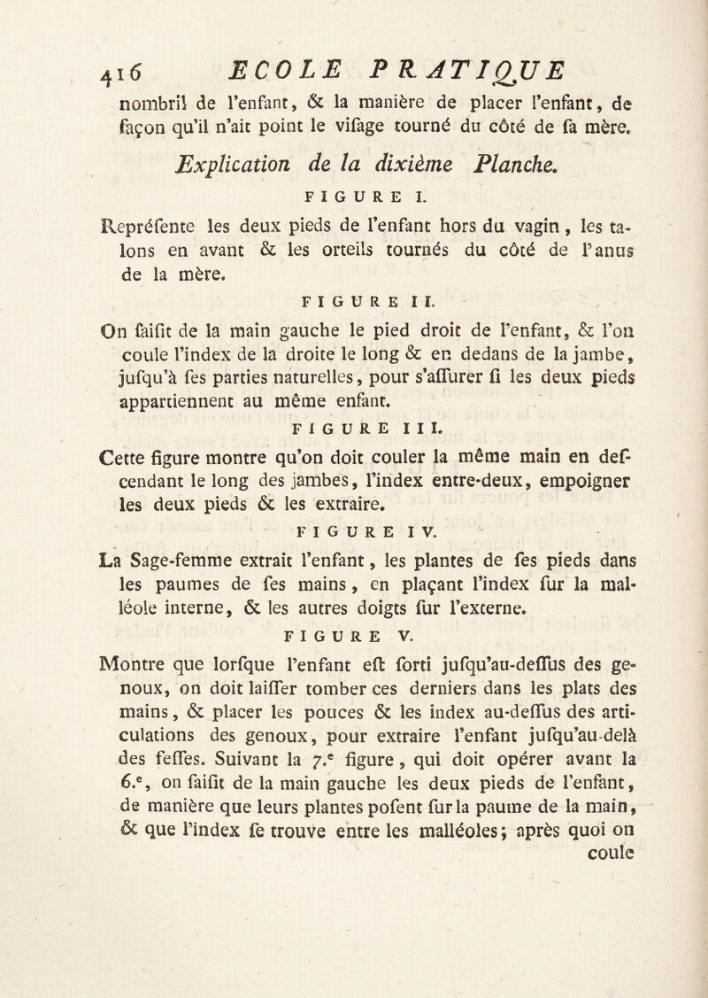 nombril de l’enfant, & la manière de placer l’enfant, de façon qu’il n’ait point le vifage tourné du côté de fa mère. Explication de la dixième Planche. FIGURE I. i Rcpréfente les deux pieds de l’enfant hors du vagin, les ta- lons en avant & les orteils tournés du côté de l’anus de la mère. s F I G U R E I I. On faifit de la main gauche le pied droit de l’enfant, & l’on coule l’index de la droite le long & en dedans de la jambe, jufqu’à fes parties naturelles, pour s’aflurer fi les deux pieds appartiennent au même enfant. \ figure III. Cette figure montre qu’on doit couler la même main en def- cendant le long des jambes, l’index entre-deux, empoigner les deux pieds & les extraire. F I G U R E I V. La Sage-femme extrait l’enfant, les plantes de fes pieds dans les paumes de fes mains, en plaçant l’index fur la mal- léole interne, & les autres doigts fur l’externe. FIGURE V. Montre que lorfque l’enfant eft fort! jufqu’au-deflus des ge- noux, on doit laifler tomber ces derniers dans les plats des mains, & placer les pouces & les index au-defllis des arti- culations des genoux, pour extraire l’enfant julqu’au-delà des feffes. Suivant la 7.* figure, qui doit opérer avant la 6.®, on faifit de la main gauche les deux pieds de l’enfant, de manière que leurs plantes pofent fur la paume de la main, & que l’index fe trouve entre les malléoles ; après quoi on coule