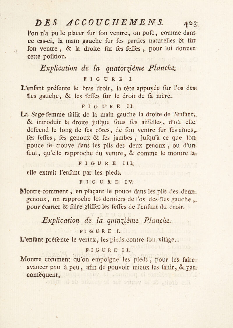 l’on n’a pu le placer fur fon ventre, on pofe, ccrmme dans ce cas-ci, la main gauche fur fes parties naturelles & fur fon ventre , & la droite fur fes fefles, pour lui donner cette pofition. Explication de la quatoriième Planche; FIGURE I. L’enfant préfente le bras droit, la tête appuyée fur l’os de&î îles gauche, & les feffes fur le droit de fa mère. FIGURE II. La Sage-femme faifît de la main gauche la droite de l’èiifant,. & introduit la droite jufque fous fes ailTelles, d’où elle defcend le long de fes côtes, de fon ventre fur fes aines,, fes fefles, fes genoux ôc fes jambes , jufqu’à ce que fon pouce fe trouve dans les plis des deux genoux , ou d’un; feul, qu’elle rapproche du ventre, & comme le montre lat FIGURE III,. elle extrait l’enfant par les pieds. FIGURE IV. Montre comment, en plaçant le pouce dans les plis des deur genoux, on rapproche les derniers de l’os des îles gauche pour écarter & faire glilferles fefles de l’enfant du droit. Explication, de la quinzième. Planche,. FIGURE I. L’enfant préfente le vertex, les pieds contre fon vifage.. FIGURE II. » » ' Montre comment qu’on empoigne les pieds, pour les faire_' avancer peu à peu, afin de pouvoir mieux les fàifir, & par.; conféquent,.