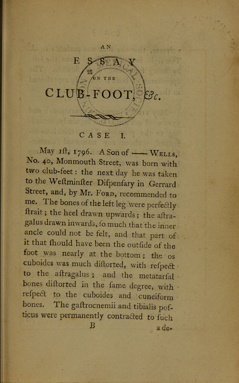 May ift, 1796. A Son of Wells, No. 40, Monmouth Street, was born with two club-feet: the next day he was taken to the Weftminfter Difpenfary in Gerrard Street, and, by Mr. Ford, recommended to me. The bones of the left leg were perfedlly ftrait; the heel drawn upwards; the aftra- galus drawn inwards, fo much that the inner ancle could not be felt, and that part of it that fhould have been the outfide of the foot was nearly at the bottom; the os cuboides was much diftorted, with refpeA to the aftragalus ; and the metatarfal bones diftorted in the lame degree, with refpedt to the cuboides and cuneiform bones. The gaftrocnemii and tibialis pof- ticus were permanently contra&ed to fuch B a de*