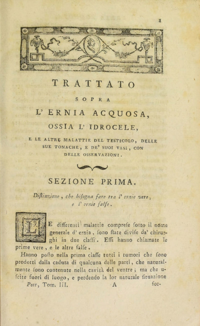 trattato , SOPRA L’ERNIA AC(iUOSA, OSSIA V IDROCELE, E LE ALTRE MALATTIE DEL TESTICOLO, DELLE SUE TONACHE, E DE* SUOI VASI, CON DELLE OSSERVAZIONI. SEZIONE PRIMA. Dìjlinzione , chs bijogna fare tra P eraie vere, e r ernie [alfe , E differeiu:^ malattie comprefe fotto U nome generale d’ ernia , fono fiate divife da’ chirur- ghi in due claffi'. Eflì hanno chiamate le prime vere , e le altre falfe . Hanno pollo nella prima clalTe tutti i tumori che fono prodotti dalla caduta di qualcuna delle parti, che natural- mente lono contenute nella cavità del ventre ; ma che u- fcite fuori di luogo, e perdendo la lor naturale fituaz:one Porr, Tom. IÌI. A 1