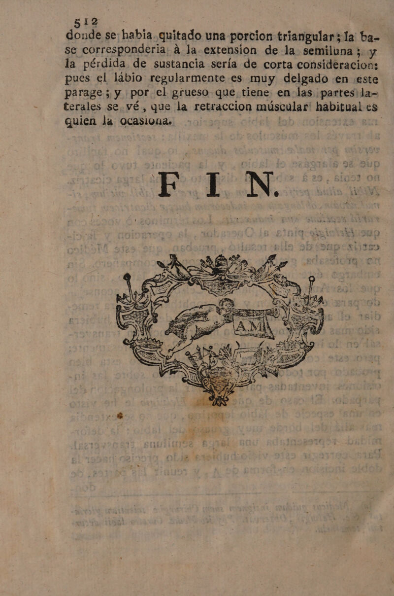 + NOE | | donde se: habia. quitado una porcion triangular; la ba- se corresponderia: à la- extension de la semiluna ;. y la pérdida de sustancia sería de corta consideracion: pues el lábio regularmente es muy delgado «en :este parage; y por el grueso que tiene en-las partesila- terales se. vé, que la retraccion múscular' habitual es quien la ocasiuna. oidab A ¡ La | FE du Re