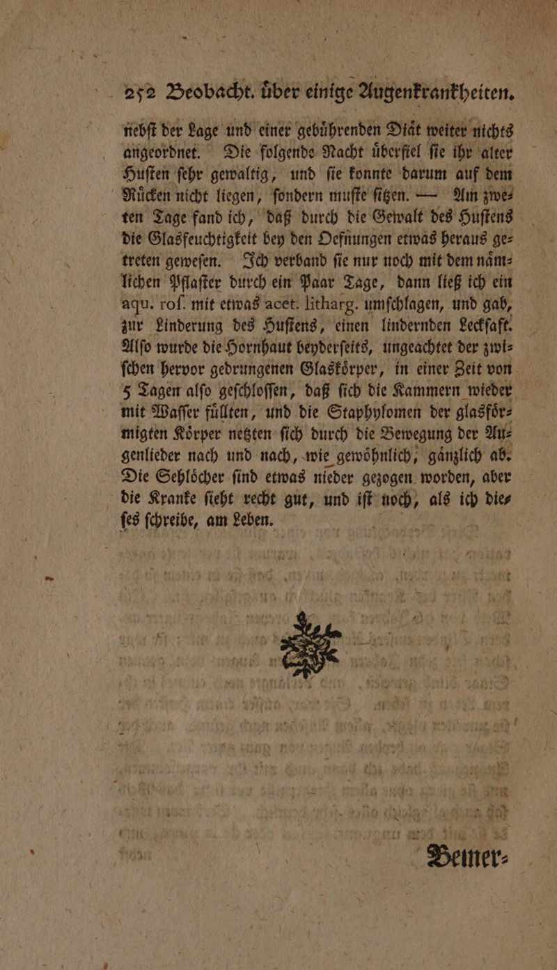 nebſt der Lage und einer gebuͤhrenden Diät weiter nichts angeordnet. Die folgende Nacht uͤberſtel fie ihr alter Huſten ſehr gewaltig, und fie konnte darum auf dem treten geweſen. Ich verband fie nur noch mit dem naͤm⸗ lichen Pflaſter durch ein Paar Tage, dann ließ ich ein aqu. rof. mit etwas acet. litharg. umſchlagen, und gab, zur Linderung des Huſtens, einen lindernden Leckſaft. Alſo wurde die Hornhaut beyderſeits, ungeachtet der zwi⸗ mit Waſſer fuͤllten, und die Staphylomen der glasfoͤr⸗ migten Koͤrper netzten ſich durch die Bewegung der Au⸗ 5 die Kranke ſieht recht gut, und a doch,! als ich die⸗ ſes ſchreibe, am Leben.