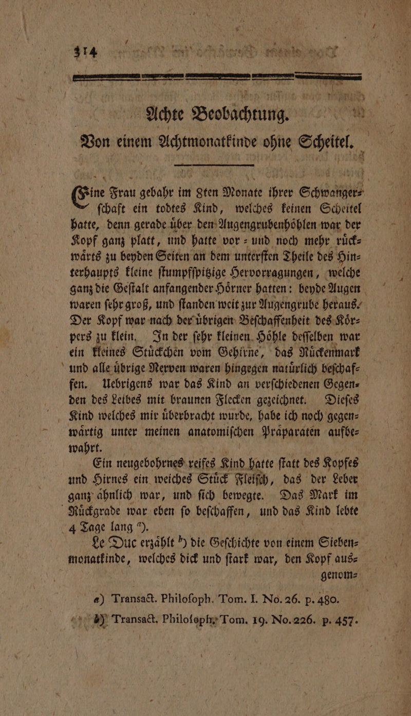 + Von einem m Achtwonattimde ohne Scheiel. — ſchaft ein todtes Kind, welches keinen Scheitel hatte, denn gerade uͤber den Augengrubenhoͤhlen war der Kopf ganz platt, und hatte vor = und noch mehr ruͤck⸗ waͤrts zu beyden Seiten an dem unterſten Theile des Hin⸗ terhaupts kleine ſtumpfſpitzige Hervorragungen, welche ganz die Geſtalt anfangender Hoͤrner hatten: beyde Augen waren ſehr groß, und ſtanden weit zur Augengrube heraus. Der Kopf war nach der uͤbrigen Beſchaffenheit des Koͤr⸗ ein kleines Stückchen vom Gehirne, das Ruͤckenmark den des Leibes mit braunen Flecken gezeichnet. Dieſes waͤrtig unter meinen anatomiſchen Praparaten aufbe⸗ wahrt. und Hirnes ein weiches Stuͤck Fleiſch, das der Leber ganz ahnlich war, und ſich bewegte. Das Mark im Le Due erzähle ') die Geſchichte von einem Sieben⸗ genom⸗ 4) Transact. Philoſoph. Tom. I. No. 26. p. 480. J Transact. Philofopm Tom. 19. No. 226. p. 457.