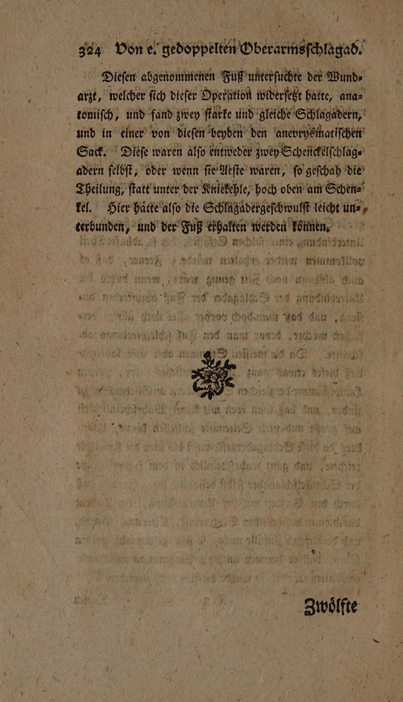 \ Dieſen abgenommenen Fuß unter ſuchte der Bunde tomiſch, und fand zwey ſtarke und gleiche Schlagadern, und in einer von dieſen beyden den anevrysmatiſchen Sack. Dieſe waren alſo entweder zwey Scheückelſchlag⸗ adern ſelbſt, oder wenn ſie Aeſte waren, ſo geſchah die kel. Hier haͤtte alſo die Schlägadergeſchwulſt leicht uns, 5 7. D he r getuni d ml. e ene eee ee elko rt auen, ee ene INE en e, ua 4 / 4 F ee * u PR PR IM Rama BR >‘: 110 ren Hi 0 774 ng AI . end rear vi BEN ö Ar 20 den NN 10 zun nen Ten. . m aan ar Ai) 137 ME BB 90 Nu 1470 ch a n y * e u 8 * I IR N 4 1 ee Frl * rn 1 * x * 7 1 An 1 ** 90 * u 2 ft 1 44 0 * * 8 2 > Kr u we * 4 U 5 r ur N 2 4 Erg Re 19 7 U * * > | | Zwoͤlfte *