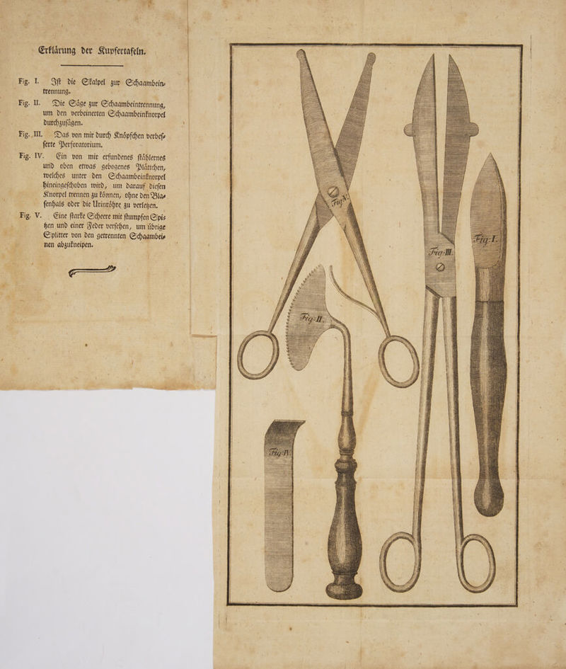 rd Erklärung der Kupfertafeln, Fig. I. Iſt die Skalpel zur Schaambein⸗ trennung. Eu Fig. II. Die Säge zur Schaambeintrennung, um den verbeinerten Schaambeinknorpel durchzuſaͤgen. 2 Fig. III. Das von mir durch Knoͤpfchen verbeſ⸗ | ferte Perforatorium. Fig. IV. Ein von mir erfundenes ſtaͤhlernes und oben etwas gebogenes Plaͤttchen, welches unter den Schaambeinknorpel hineingeſchoben wird, um darauf dieſen Knorpel trennen zu konnen, ohne den Bla⸗ ſenhals oder die Urinroͤhre zu verletzen. f | Fig. V. Eine ſtarke Scheere mit ſtumpfen Spi⸗ tzen und einer Feder verſehen, um uͤbrige Splitter von den getrennten Schaambei⸗ nen abzukneipen. 5