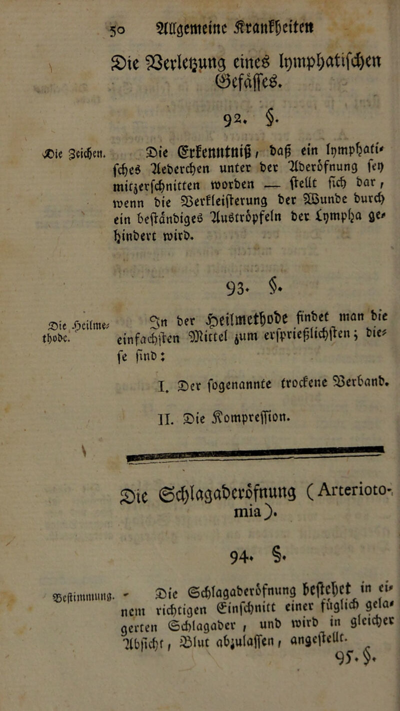 £>ie 93evleßung eines tymp&attfdjen 0efdffeS. 92. §• #ie Seiten. Sie (£rfett«tttiß, ein ftjmpfcaft' fcf)c6 3leberd)en unter ber Tlberofnung fei) mirjerfdjnitten worben — fteüt flrf) bar, wenn bie SBerfleifterung ber Söunbc burd) ein beffänbigeö 2lu$tr&pfeln ber Xgmplja ge* Ijinbevt wirb. 93- §• »ie Seite« 3« 6« £>ei!metf)oi>e ffntef «i«» bic tSsc. «nfacfjjkn ®i«el »um «fpriefilitflfien; 61« fe finb: I. ©er fogenannte trodene Soerbanb. II. ©ie f omprefiton. Sie <Sd)tagai>cv6fmmg (Arterioto-, mia). 94. §. SBeüimniuits. - Sic <5c&lagaber6fmmg tcftc^ct • ei- nem richtigen ©nf<&#itt cm« fugli* ä^a- g«ten ©Aleigab« , unb roitb m glcitt)« 7tb|icf)t, iSIut abiuluffcn, angeflcUc. 9S-.§.