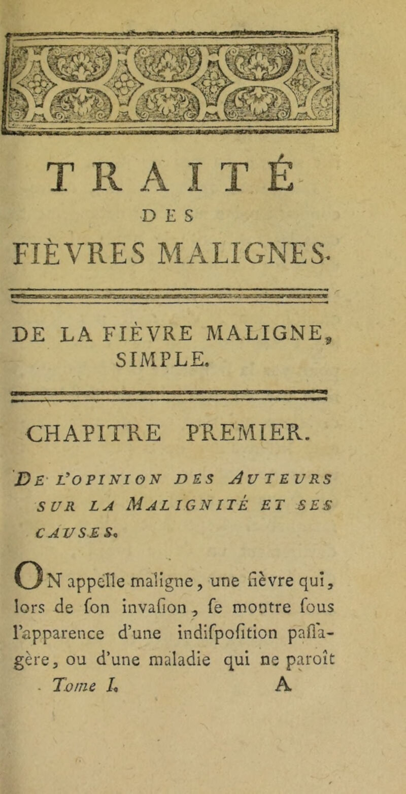 DES / FIÈVRES MALIGNES. ■■fini,jm i ii mi ii u-_T3 *- ..■■-■ — DE LA FIÈVRE MALIGNE, SIMPLE. CHAPITRE PREMIER. De l’o pi ni on des Auteurs sur la Malignité et ses causes, ON appelle maligne, une fièvre qui, lors de Ion invafion, le montre fous l’apparence d’une indifpofition pafla- gère, ou d’une maladie qui ne paroît - Tv/ne h A