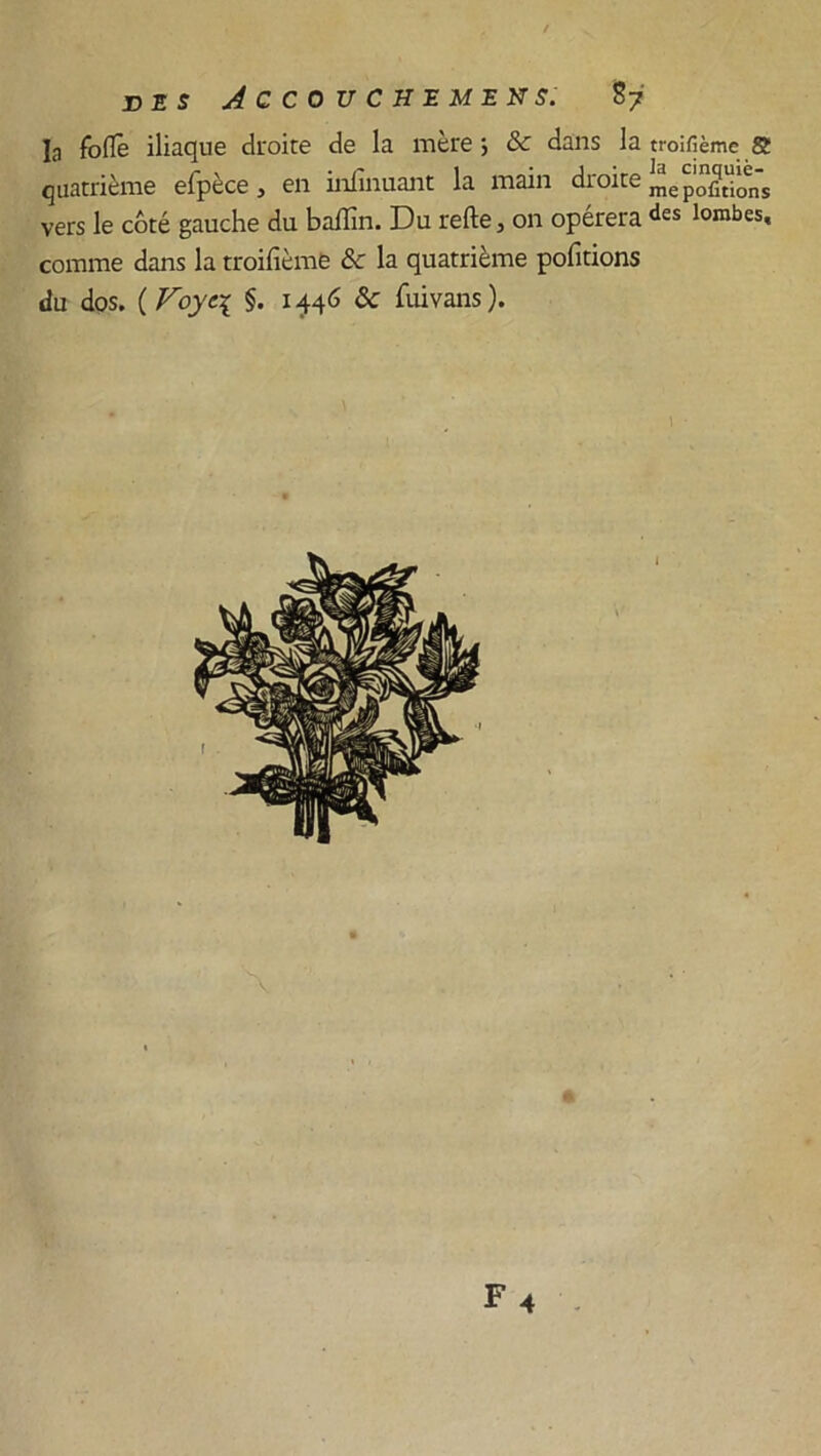 DES JCCOUCHEMENS. 87 la fofïè iliaque droite de la mère ; & dans la troifième S quatrième efpèce , en infinuant la main droite prions vers le côté gauche du baflîn. Du refte, on opérera des lombes, comme dans la troifième ôc la quatrième pofitions du dos. ( Voyt\ §. x 446 & fuivans ).