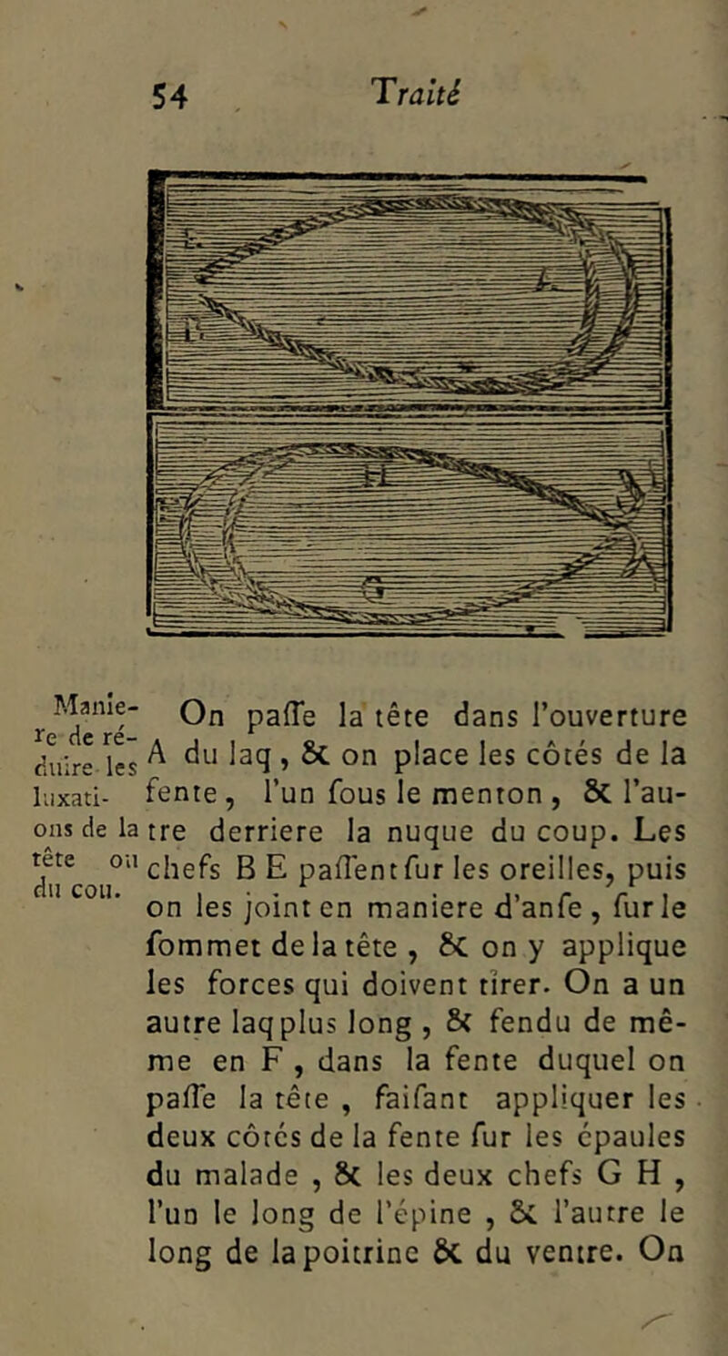 On paffe la tête dans l’ouverture duire les ^ ^ place les côtés de la liixati- fente, l’un fous le menton , & l’au- ons de la tre derrière la nuque du coup. Les tete ou chefs B E paflêntfur les oreilles, puis du cou. 1 • • • r r I on les joint en maniéré a anfs, furie fommet delà tête , 6c on y applique les forces qui doivent tirer. On a un autre laqplus long , & fendu de mê- me en F , dans la fente duquel on pafle la tête , faifant appliquer les deux côtés de la fente fur les épaules du malade , 8( les deux chefs G H , l’un le long de l’épine , ÔC l’autre le long de la poitrine ôc du ventre. On