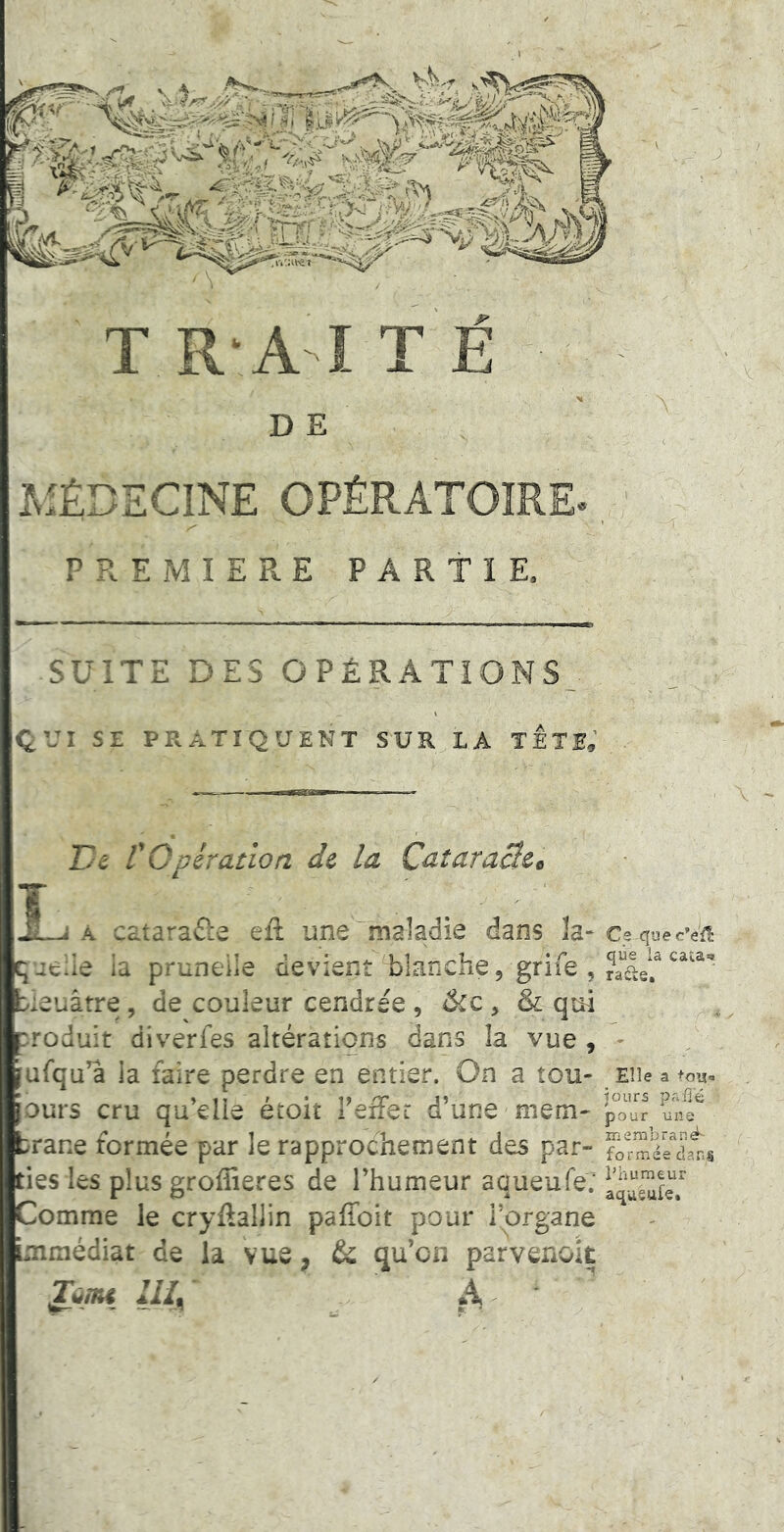 SUITE DES OPÉRA QVI SE PRATIQUENT SUR D E AIÉDECINE OPÉRA De rOpération de la Caîaracleo L A catarafie efl: une maladie dans h- Cs quecVf^ queue la pruneile aevient blanciie, grue , leuârre, de couleur cendrée , &c, & qui roduit diverfes altérations dans la vue , ' ufqu’â la faire perdre en entier. On a tou- eu le a +o’j['a 1 iT ' • i> 'T Jî îours pafi'é ours cru quelle etoit refier d une mem- pour une 'race formée par le rapprochement des par- :ies les plus groffieres de Thumeur aqueufe; ^ Gomme le cryflallin paffoit pour l’organe mmédiat de la vue, & qu’on parvenok humeur aqueufe.