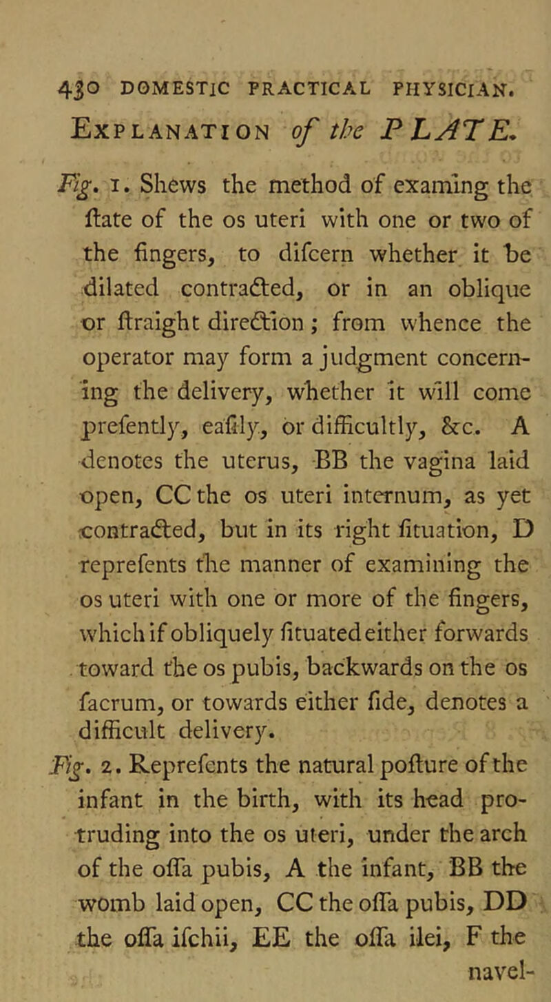 Explanation of the PLATE* Fig, 1. Shews the method of examlng the ftate of the os uteri with one or two of the fingers, to difcern whether it te dilated contrafted, or in an oblique or ftraight direction ; from whence the operator may form a judgment concern- ing the delivery, whether it will come prefently, eafily, or difficultly, &c. A denotes the uterus, BB the vagina laid open, CC the os uteri internum, as yet oontradted, but in its right fituation, D reprefents tlie manner of examining the os uteri with one or more of the fingers, which if obliquely fituated either forwards toward the os pubis, backwards on the os facrum, or towards either fide, denotes a difficult delivery. Eg. 2. Reprefents the natural pofiure of the infant in the birth, with its head pro- truding into the os uteri, under the arch of the ofla pubis, A the infant, BB the womb laid open, CC the ofla pubis, DD the ofla ifchii, EE the oflTa ilei, F the navel-