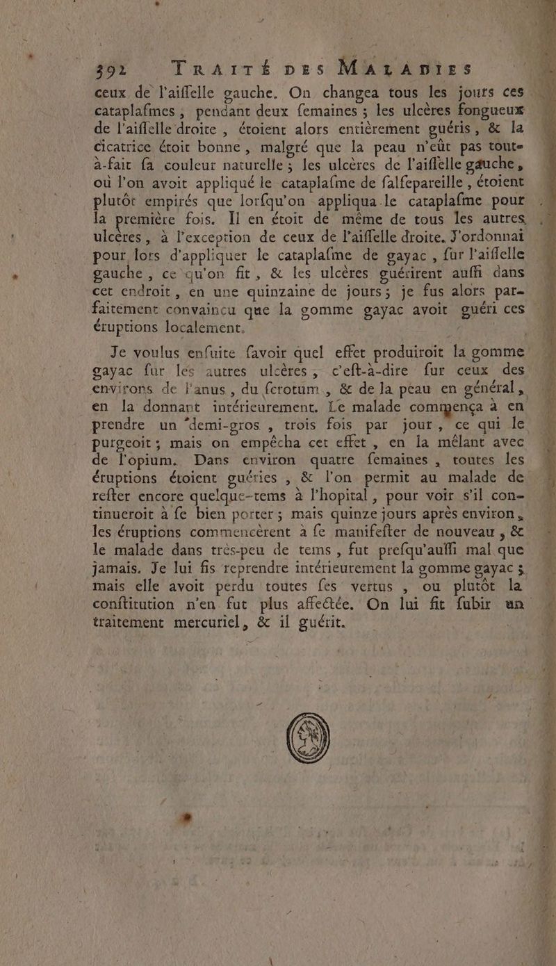 ceux de l'aiffelle gauche. On changea tous les jours ces cataplafmes ; pendant deux femaines ; les ulcères fongueux de l’aiflelle droite , étoient alors entièrement guéris, & la cicatrice étoit bonne, malgré que la peau n’eût pas toute a-faic fa couleur naturelle; les ulcères de l'aiffelle gauche, où l’on avoit appliqué le cataplafme de falfepareille , étoient plutôt empirés que lorfqu’on appliqua le cataplafme pour la première fois. Il en étoit de même de tous les autres ulcères, à l'exception de ceux de l’aiffelle droite. J'ordonnai pour lors d'appliquer le cataplafme de gayac , fur l’aiflelle gauche , ce qu'on fit, & les ulcères guérirent auffi dans cet endroit, en une quinzaine de jours; je fus alors par- , . éruptions localement. / gayac fur les autres ulcères, c'eft-a-dire fur ceux des en la donnant intérieurement. Le malade commença à en prendre un “demi-gros , trois fois par jour, ce qui le purgeoit; mais on empécha cet effet , en la mêlant avec de l'opium. Dans environ quatre femaines , toutes les éruptions étoient guéries , & l’on permit au malade de refter encore quelque-tems à l'hopital, pour voir s’il con- tinueroit à fe bien porter; mais quinze jours après environ, le malade dans très-peu de tems , fut prefqu’aufli mal que jamais. Je lui fis reprendre intérieurement la gomme gayac 3 mais elle avoit perdu toutes fes vertus , ou plutôt la traitement mercuriel, & il guérit. ROUE US ee ee ” 4 soy a