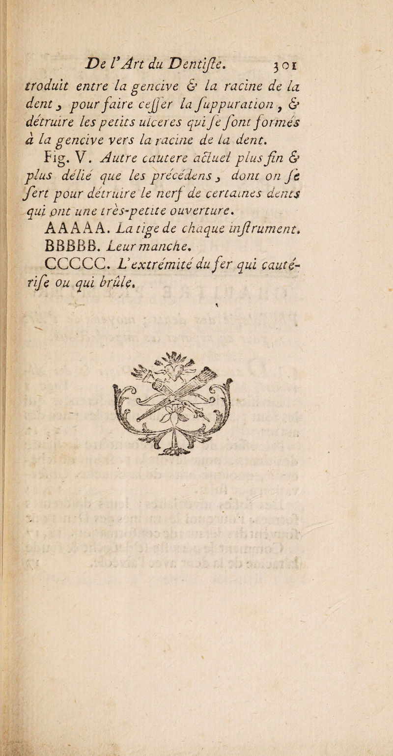 troduit entre la gencive & la racine de la dent j pour faire cejjer la fuppuration 9 & détruire les petits ulcérés qui Je font formés à la gencive vers la racine de la dent. Fig. V. Autre cautere actuel plus fin & plus délie que les précédé ns dont on je fiert pour détruire le nerf de certaines dents qui ont une très-petite ouverture. AAÀAA. La tige de chaa±ue infiniment» BBBBB. Leur manche, CCCCC. L extrémité du fer qui cauté- rifie ou qui brûle.