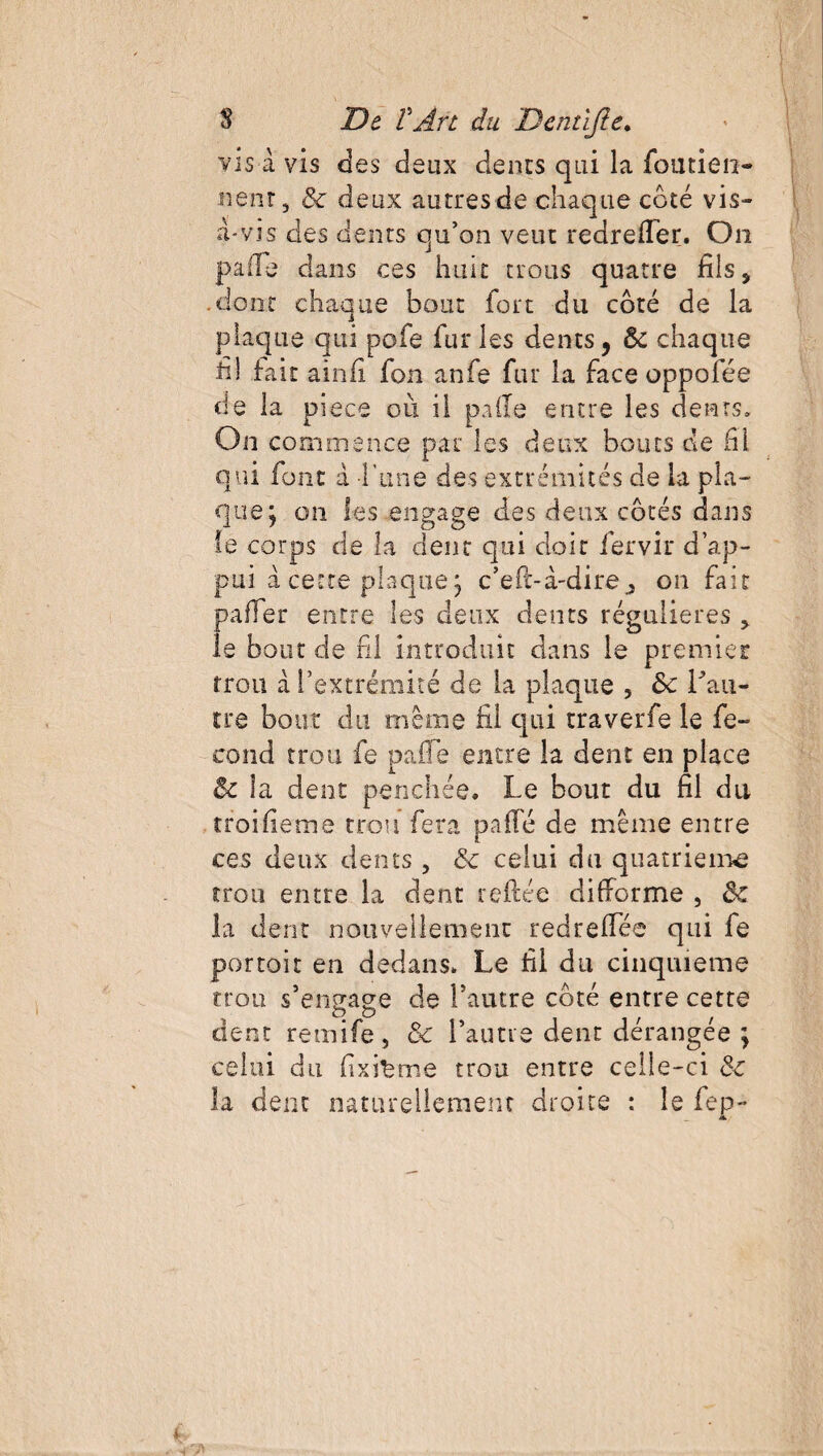 vis à vis des deux dents qui la forment- nenr, & deux autres de chaque côté vis¬ a-vis des dents qu’on veut redrefier. On paiïe dans ces huit trous quatre fils, .dont chaque bout fort du côté de la plaque qui pofe fur les dents, & chaque fil fait ainfi fon anfe fur la face oppofée de la piece où il pâlie entre les dents. On commence par les deux bouts de fil qui font à l'une des extrémités de la pla¬ que; on les engage des deux côtés dans le corps de la dent qui doit fervir d’ap¬ pui à cette plaque; c’eft-à-direon fait paffer entre les deux dents régulières , le bout de fil introduit dans le premier trou à l’extrémité de la plaque , 8c lou¬ tre bout du même fil qui traverfe le fé¬ cond trou fe pafie entre la dent en place 5c la dent penchée* Le bout du fil du rroifieme trou fera pafie de même entre ces deux dents, 8c celui du quatrième trou entre la dent refiée difforme , 8c la dent nouvellement redrefiee qui fe portoit en dedans* Le fil du cinquième trou s’engage de l’autre côté entre cette dent remife, ôc l’autre dent dérangée ; celui du fixisme trou entre celle-ci 8c la dent naturellement droite : le fep-