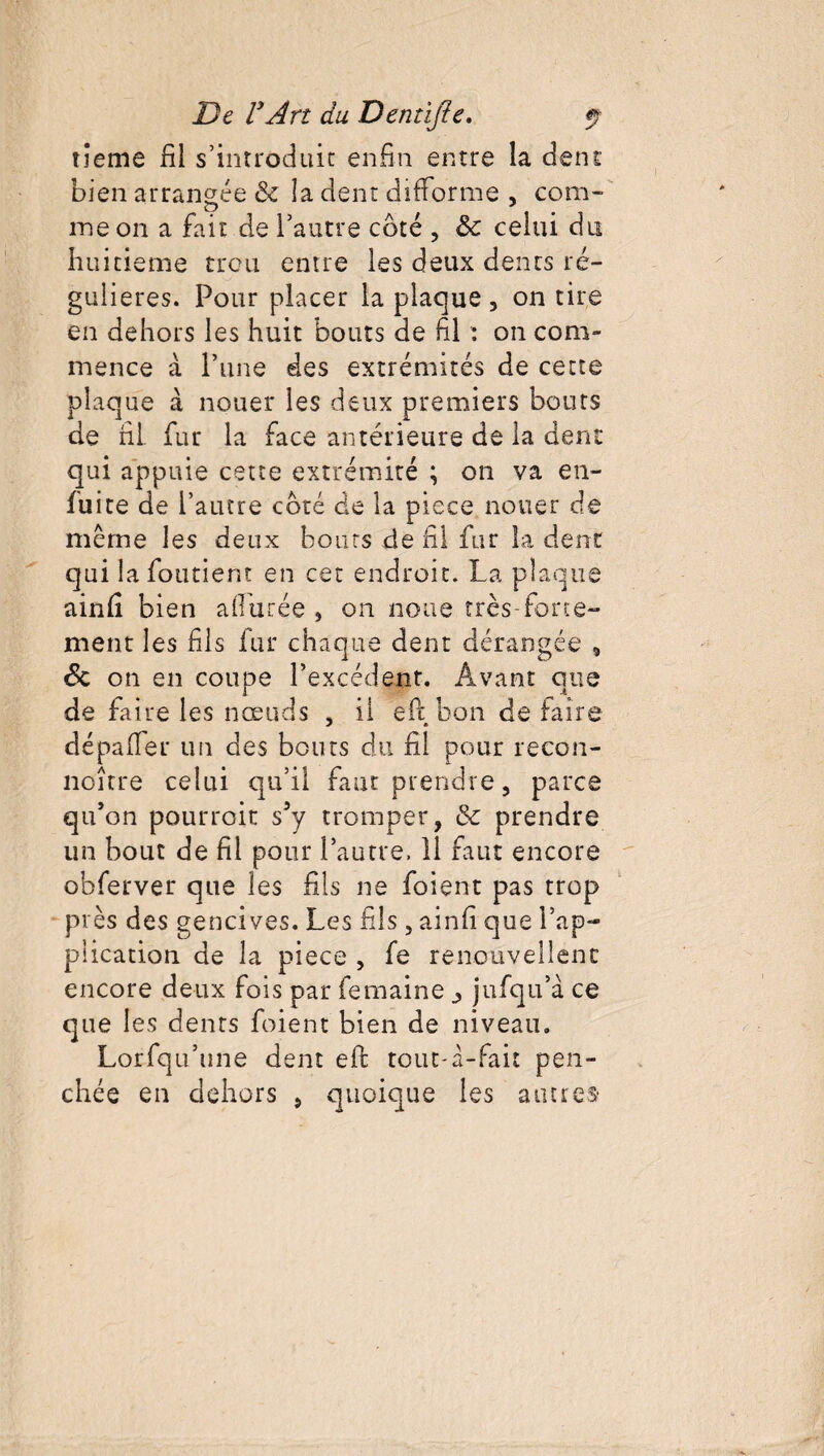 tieme fil s’introduit enfin entre la dent bien arrangée & la dent difforme , com- me on a fait de l’autre côté , &c celui du huitième trou entre les deux dents ré¬ gulières. Pour placer la plaque , on tire en dehors les huit bouts de fil : on com¬ mence à l’une des extrémités de cette plaque à nouer les deux premiers bouts de fil. fur la face antérieure de la dent qui appuie cette extrémité ; on va en- fuite de l’autre côté de la piece nouer de même les deux bouts de fil fur la dent qui la fondent en cet endroit. La plaque ainfi bien allurée , on noue très forte¬ ment les fils fur chaque dent dérangée „ & on en coupe l’excédent. Avant que de faire les nœuds , il eft bon de faire dépafler un des bouts du fil pour recon- noître celui qu’il faut prendre, parce qu’on pourroit s’y tromper, & prendre un bout de fil pour l’autre. 11 faut encore obferver que les fils ne foient pas trop près des gencives. Les fils , ainfi que l’ap¬ plication de la piece , fe renouvellent encore deux fois par femaine ^ jufqu’à ce que les dents foient bien de niveau. Lorfqu’ime dent eft tout-à-fait pen¬ chée en dehors , quoique les autres'