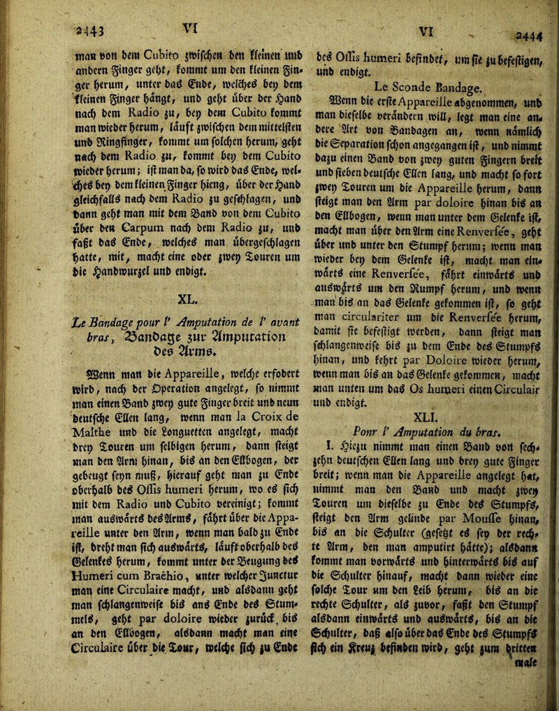 waö öon bem Cubito b«t ffelnm mib anbertt ginger gei>t, lorarat um ben f(einen gin» ger unter baö 0ibe, wcfcbeö bei; bem Keinen ginger bungf, unb ge^f über ber Jjanb tia(^ bem Radio ju, bep bem Cubito foramf manwieber^trnm, louft jwifcben bemiuittelflen ttttb 3lingjtngfr, fommt umfoldien btfuni, gebt n«cb bem Radio jUr fommt bei; bem Cubito toieber herum; ifl man ba, fo mirb ba^ ^nbe, meU (^eöbe^ bem f(einen ginger hicng, uberber^anb gleichfa((^ nach bem Radio ju gefthfagen, unb tann geht man mit bem ^anb non bem Cubito über ben Carpuin nai^ bem Radio ju, unb fagt baö ^nbe^ »eichet man ubergefchiagen hatte, mit, macht eine ober jwep ^louren um hie Jjanbwurjef unb enbigt. XL. Le Bandage pour t* Amputation de V avant bras, ^anöage sur ^Imputation Oes 7lvm&* ?Sentt man bie Appareille, tt>e(d;e erfobert wirb, na^ bcr Operation angelegt, fo nimmt mon einen SBanb jwep gute ginger breit unb neun beutfi^e (Stten lang, wenn man la Croix de Maltbe unb bie gonguetten angelegt, macht brep Souren um felblgen htmni, bann fieigt man ben 91rm hinan, biö an bcn€(Ibogen, ber gebeugt fepn muß, hierauf geht man }u <?nbe oberhalb be^ Oflls humeri hemni, tro eö (ich mit bem Radio unb Cubito bereinigt; fommt man auömartö beö2(rm^, fahrt über bie Appa- teiiie unter ben 2(rm, wenn man halb 511 €nbe i^, breht man fl(h au^warW, lauft oberhalb beö ®elenfeö herum, fommt unter ber Beugung be^ Humeri cum Braehio, unter Welcher ^uRCtur man eine Circulaire mad}t, unb ali^bann geht man fchlangenweife bid and ^nbe bed @tum« meid, geht par doloire »ieber juriScf. bid an ben Ellbogen, aldbann macht man eine Circulaire über bie Xotir, welche (ich |u^obe 3444 bed Ollis humeri beftnbef, umfie iubefejligen, unb enbigt. Le Scoiide Bandage. SCBenn bie erfle Appareille abgenommen, imb man bicfelbc oeranbern will, legt man eine an« bere SKrf non i^anbagen an, wenn ndmiieh bie ©eparation fchon angegangen ifl, unb nimmt baju einen jßanb non iwep guten gingern breit unb fieben beutfehe €(lcn lang, unb macht fo fort jwep Xouren um bie Appareille herum, bann (leigt man ben 2lrm par doloire hinan bid an ben gebogen, wenn man unter bem ©clenfc ifl, macht man ttber benSlrm eine Renverfee, geht über unb unter ben ©tumpf herum; wenn man wieber bep bem ©elenfe ifl, macljt man ein« wdrtd eine Renverfee, fahrt einwdrtd unb audwilrtd um ben Stumpf herum, unb wenn man bid an bad ©elenfc gefommen ifl, fo geht man circulariter um bie Renverfee herum, bamit fte bcfeiligt werben, bann fieigt man fehlangenweife bid ju bem gnbe bed ©fumpfd hinan, unb fehrt par Doloire wiebcr herum, wenn man bid an bad©elenfe gefommen, macht man unten um Os humeri einen Circulair unb enbigt. XLL Ponr l’ Amputation du hras, I. nimmt mon einen SSaiib oort fech- jehn beutfehen Ctten lang unb brep gute ginger breit; wenn man bie Appareille angelegt hat, nimmt man ben ^anb unb macht jwep Xouren um biefelbc ju gnbe bed ©tumpfd, flefgt ben 3lrm geliube par MoulTe hinan, bid an bie ©chultcr (gefegt ed fep ber rech» te 2lrm, ben man amputirt hatte); aldbanit fommt man borwdrtd unb hinterwdrfd bid auf bie ©d)ulter hinauf, macht bann wieber eine folche Xour um ben Seib htrum, bid an bie rechte ©chulter, ald jueor, fagt ben ©tumpf aldbann einwdrtd unb audwdrtd, bid an bie ©chulter, bag «Ifouberbadgnbe bed ©tumpfd ^(h (in ^reuj btfliiben wirb, geht jum l^ritteit