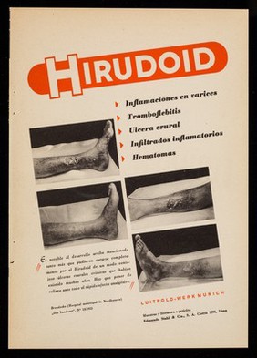 Hirudoid ... : Clauden es de efecto rápido y seguro ... / Luitpold-Werk Munich ; literatura a petición Edmundo Stahl & Cia., S.A.