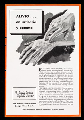 Alivo... en urticaria y eczema ... Líquido Esplénico Inyectable Armour ... : Eritropoyesis ... Extracto de Médula Roja Armour / The Armour Laboratories.