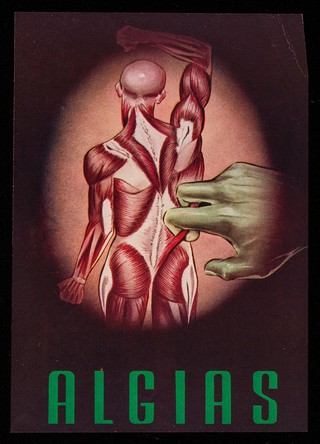 Algias : Mio-Ina, medicación sinergica, antialgica y desensibilizante : vitamina B1 ...  / Laboratorios Vieta-Plasencia, S.A.