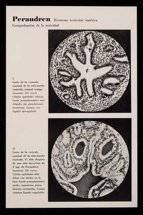 Perandren : hormona testicular sintética / CIBA.