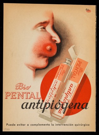 Bio Pental Antipiógena puede evitar o complimenta la intervencíón quirúrgica : La metritis colibacilar es debida al paso periódico del B. coli a través del tractus genital : Coli-Om la previene y la cura / Estudio Om.