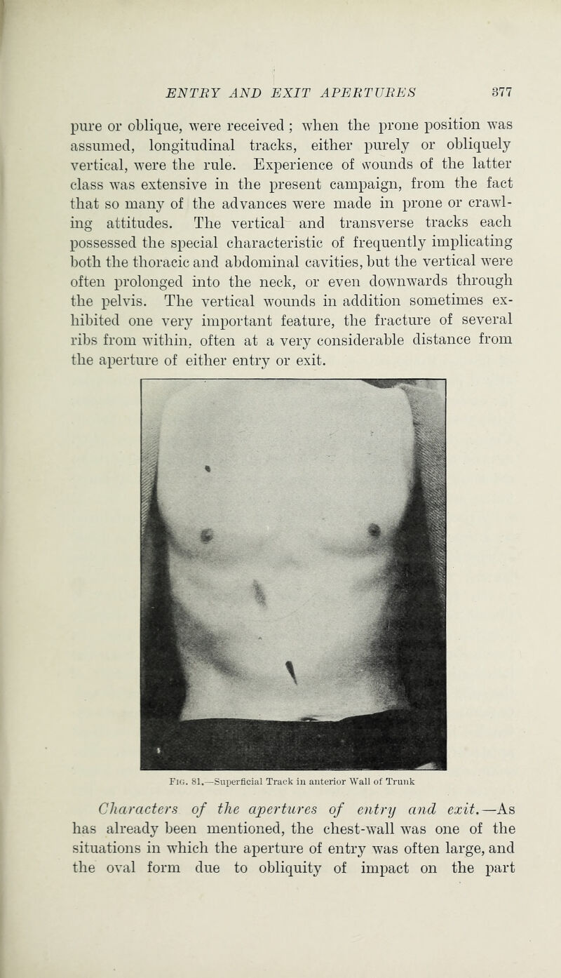 pure or oblique, ^Ye^e received ; when the prone position was assumed, longitudinal tracks, either purely or obliquely vertical, were the rule. Experience of wounds of the latter class was extensive in the present campaign, from the fact that so many of the advances were made in prone or crawl- ing attitudes. The vertical and transverse tracks each possessed the special characteristic of frequently implicating both the thoracic and abdominal cavities, but the vertical were often prolonged into the neck, or even downwards through the pelvis. The vertical wounds in addition sometimes ex- hibited one very important feature, the fracture of several ribs from within, often at a very considerable distance from the aperture of either entry or exit. Fig. 81.—Superficial Track in anterior Wall of Trunk Characters of the apertures of entry and exit.—As has already been mentioned, the chest-wall was one of the situations in which the aperture of entry was often large, and the oval form due to obliquity of impact on the part