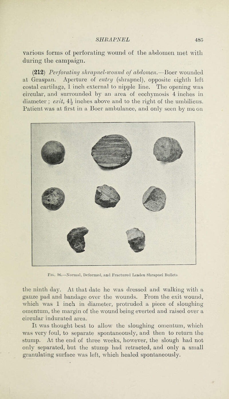 various forms of perforating wound of the abdomen met with during the campaign. (212) Perforating shrapnel-tvound of abdomen.—Boer wounded at Graspan. Aperture of entry (shrapnel), opposite eighth left costal cartilage, 1 inch external to nipple line. The opening was circular, and surrounded by an area of ecchymosis 4 inches in diameter; exit, 4| inches above and to the right of the umbilicus. Patient was at first in a Boer ambulance, and only seen by me on Fig. 96.—Xormal, Deformed, and Fractured Leaden Shrapnel Bullets the ninth day. At that date he was dressed and walking with a gauze pad and bandage over the wounds. From the exit wound, which was 1 inch in diameter, protruded a piece of sloughing omentum, the margin of the wound being everted and raised over a circular indurated area. It was thought best to allow the sloughing omentum, which was very foul, to separate spontaneously, and then to return the stump. At the end of three weeks, however, the slough had not only separated, but the stump had retracted, and only a small granulating surface was left, which healed spontaneously.