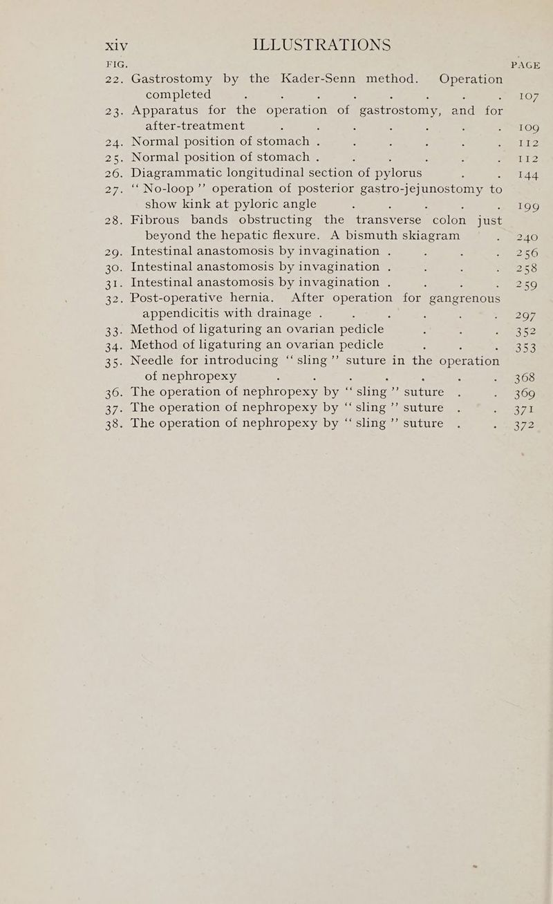 FIG. PAGE 22. Gastrostomy by the Kader-Senn method. Operation completed : : : ealOT 23. Apparatus for the operation ae pastroston and for after-treatment . : 4 : : aFeLOG 24. Normal position of stomach . : : : : be he 25. Normal position of stomach . ; : fy mye 26. Diagrammatic longitudinal section of smutene. : 144 27. ‘‘No-loop’’ operation of posterior gastro-jejunostomy % show kink at pyloric angle : ; 199 28. Fibrous bands obstructing the transverse Polen just beyond the hepatic flexure. A bismuth skiagram 240 2g. Intestinal anastomosis by invagination . 256 30. Intestinal anastomosis by invagination . ; : SoS 31. Intestinal anastomosis by invagination . 259 32. Post-operative hernia. After operation for gangrenous appendicitis with drainage . : * ; ; ret P26, 33. Method of ligaturing an ovarian pedicle : : yngs2 34. Method of ligaturing an ovarian pedicle 35. Needle for introducing ‘sling ’’ suture in the operation of nephropexy : 306 36. The operation of Ayano: BY s eine a ertire : ae 2300 37. The operation of nephropexy by ‘“‘sling’’ suture . oS 7a 38. The operation of nephropexy by “‘sling’’ suture . Baik ye