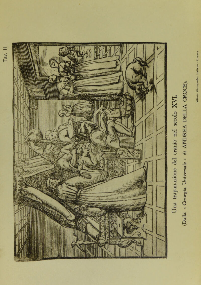 Una trapanazione del cranio nel secolo XVI, (Dalla « Cirurgia Universale » di ANDREA DELLA CROCE),