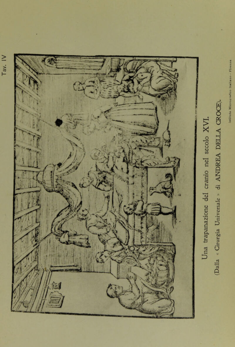 Al Una trapanazione del cranio nel secolo XVI. (Dalla « Grurgia Universale » di ANDREA DELLA CROCE).