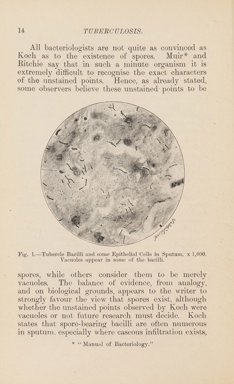 All bacteriologists are not quite as convinced as Koch as to the existence of spores. Muir* and Ritchie say that in such a minute organism it is extremely difficult to recognise the exact characters of the unstained points. Hence, as already stated, some observers believe these unstained: points to be Fig. 1.—Tubercle Bacilli and some Epithelial Cells in Sputum. x 1,000. Vacuoles appear in some of the bacilli. spores, while others consider them to be merely vacuoles. The balance of evidence, from analogy, and on biological grounds, appears to the writer to strongly favour the view that spores exist, although whether the unstained points observed by Koch were vacuoles or not future research must decide. Koch states that spore-bearing bacilli are often numerous in sputum, especially where caseous infiltration exists, * “ Manual of Bacteriology.”