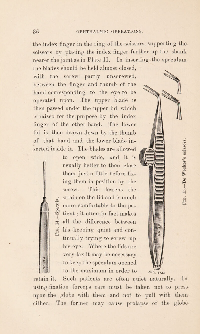 a O HH the index finger in the ring of the scissors, supporting the scissors by placing the index finger further up the shank nearer the joint as in Plate 11. In inserting the speculum the blades should be held almost closed, with the screw partly unscrewed, between the finger and thumb of the hand corresponding to the eye to be operated upon. Tlie upper blade is then passed under the upper lid which is raised for the purpose by the index finger of the other hand. The lower lid is then drawn down by the thumb of that hand and the lower blade in- serted inside it. The blades are allowed to open wide, and it is usually better to then close them just a little before fix- ing them in position by the screw. This lessens the strain on the lid and is much more comfortable to the pa- tient ; it often in fact makes all the difference between his keeping quiet and con- tinually trying to screw up his eye. Where the lids are very lax it may be necessary to keep the speculum opened to the maximum in order to full size retain it. Such patients are often quiet naturally. In using fixation forceps care must be taken not to press upon the globe with them and not to pull with them either. The former may cause prolapse of the globe