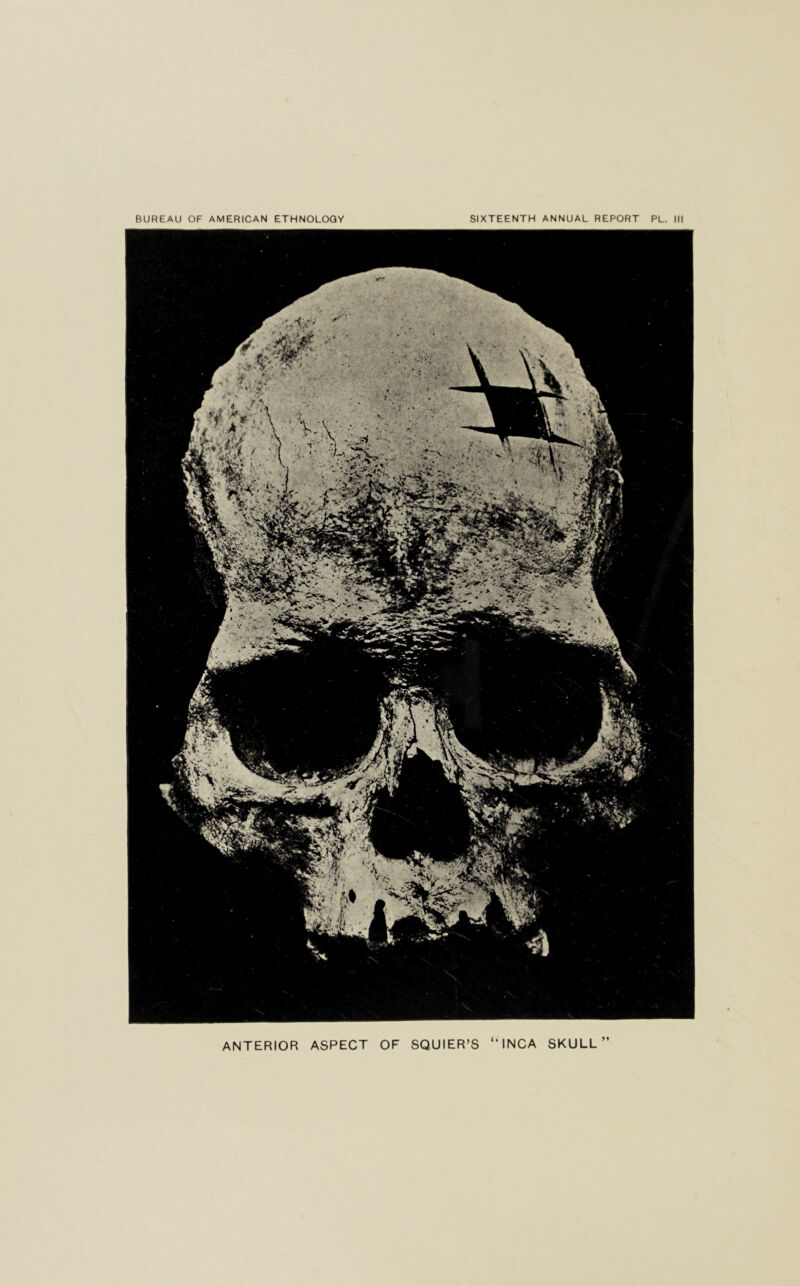 ANTERIOR ASPECT OF SQUIER’S ‘‘INCA SKULL