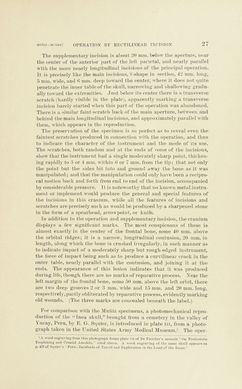 MUNIZ—MC GEE] The supplementary incision is about 20 mm. below the aperture, near the center of the anterior part of the left parietal, and nearly parallel with the more nearly longitudinal incisions of the principal operation. It is precisely like the main incisions, V-shape in section, 42 mm. long, 5 mm. wide, and G mm. deep toward the center, where it does not quite penetrate the inner table of the skull, narrowing and shallowing gradu- ally toward the extremities. Just below its center there is a transverse scratch (hardly visible in the plate), apparently marking a transverse incision barely started when this part of the operation was abandoned. There is a similar faint scratch back of the main aperture, between and behind the main longitudinal incisions, and approximately parallel with them, which appears in the reproduction. The preservation of the specimen is so perfect as to reveal even the faintest scratches produced in connection with the operation, and thus to indicate the character of the instrument and the mode of its use. The scratches, both random and at the ends of some of the incisions, show that the instrument had a single moderately sharp point, thicken- ing rapidly to 3 or 4 mm. within G or 7 mm. from the tip; that not only the point but the sides bit into and ground away the bone as it was manipulated; and that the manipulation could only have been a recipro- cal motion back and forth from end to end of the incision, accompanied by considerable pressure. It is noteworthy that no known metal instru- ment or implement would produce the general and special features of the incisions in this cranium, while all the features of incisions and scratches are precisely such as would be produced by a sharpened stone in the form of a spearhead, arrowpoint, or knife. In addition to the operation and supplementary incision, the cranium displays a few significant marks. The most conspicuous of these is almost exactly in the center of the frontal bone, some 40 mm. above the orbital ridges; it is a narrow, longitudinal contusion, 20 mm. in length, along which the bone is crushed irregularly, in such manner as to indicate impact of a moderately sharp but rough-edged instrument, the force of impact being such as to produce a curvilinear crack in the outer table, nearly parallel with the contusion, and joining it at the ends. The appearance of this lesion indicates that it was produced during life, though there are no marks of reparative process. Xear the left margin of the frontal bone, some 50 mm. above the left orbit, there are two deep grooves 2 or 3 mm. wide and 15 mm. and 20 mm. long, respectively, partly obliterated by reparative process, evidently marking old wounds. (The three marks are concealed beneath the label.) For comparison with the Muniz specimens, a photomechanical repro- duction of the “Inca skull,” brought from a cemetery in the valley of A ucay, Peru, by E. G-. Squier, is introduced in plate m, from a photo- graph taken in the United States Army Medical Museum.1 The oper- 1 A wood engraving from this photograph forms plate vii of Dr Fletcher's memoir “ On Prehistoric Trephining and Cranial Amulets, ’ cited above. A wood engraving of the same skull appears on p. 457 of Squier's “ Peru—Incidents of Travel and Exploration in the Land of the Incas.”