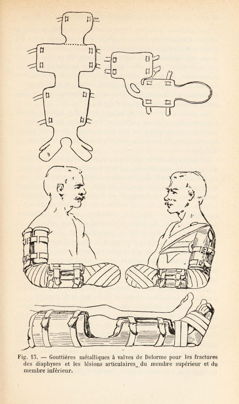 —„ c 0 c Fig. 13. — Gouttières métalliques à valves de Delorme pour les fractures des diaphyses et les lésions articulaires^ du membre supérieur et du membre inférieur.