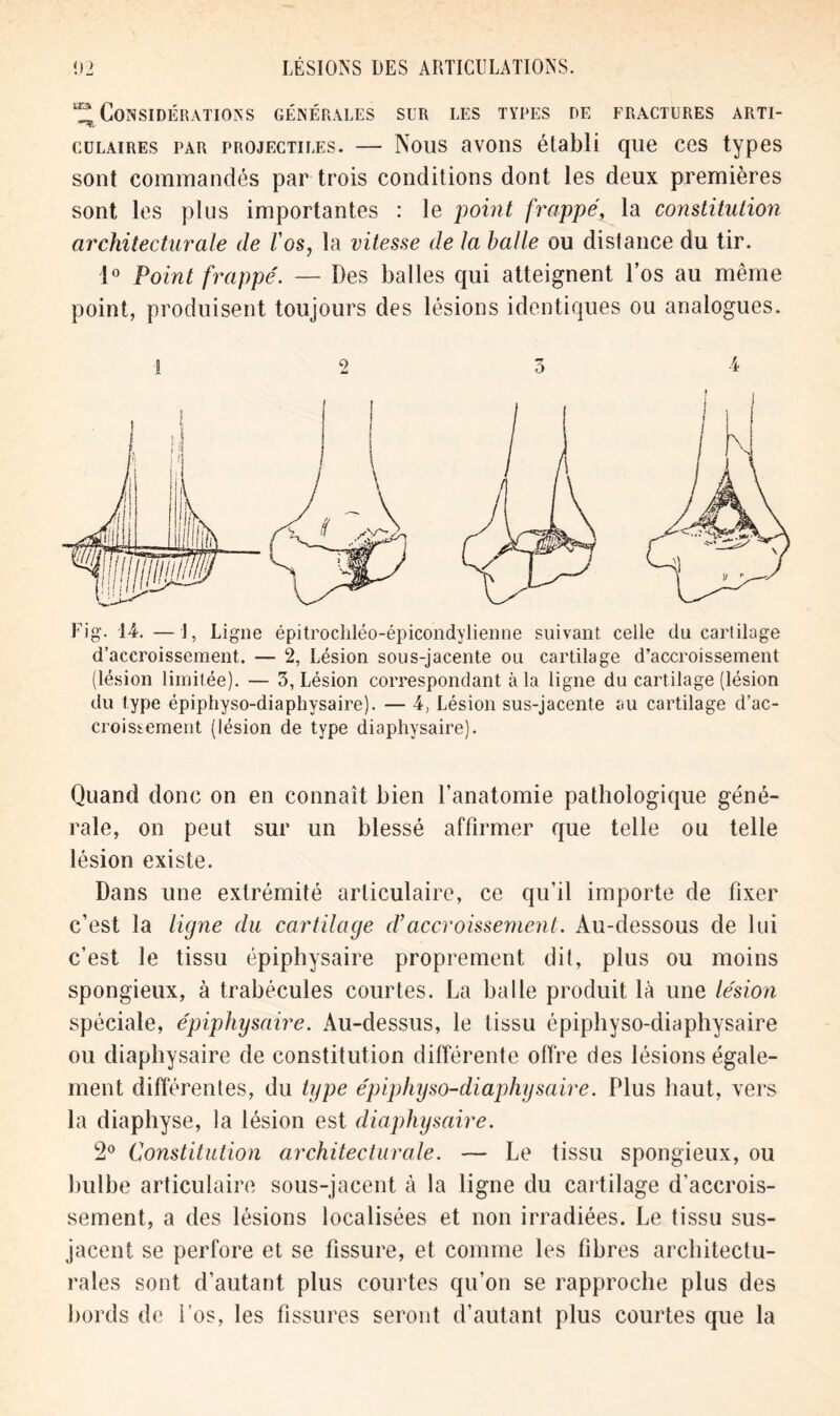 ^Considérations générales sur les types de fractures arti- culaires par projectiles. — Nous avons établi que ces types sont commandés par trois conditions dont les deux premières sont les plus importantes : le point frappé, la constitution architecturale de F os, la vitesse de ta balle ou distance du tir. 1° Point frappé. — Des balles qui atteignent l’os au même point, produisent toujours des lésions identiques ou analogues. Fig. 14. —J, Ligne épitrochléo-épicondylienne suivant celle du cartilage d’accroissement. — 2, Lésion sous-jacente ou cartilage d’accroissement (lésion limitée). — 3, Lésion correspondant à la ligne du cartilage (lésion du type épiphyso-diaphysaire). — 4, Lésion sus-jacente au cartilage d’ac- croishement (lésion de type diaphysaire). Quand donc on en connaît bien l’anatomie pathologique géné- rale, on peut sur un blessé affirmer que telle ou telle lésion existe. Dans une extrémité articulaire, ce qu’il importe de fixer c’est la ligne du cartilage d’accroissement. Au-dessous de lui c’est le tissu épiphysaire proprement dit, plus ou moins spongieux, à trabécules courtes. La balle produit là une lésion spéciale, épiphysaire. Au-dessus, le tissu épiphyso-diaphysaire ou diaphysaire de constitution différente offre des lésions égale- ment différenles, du type épiphyso-diaphysaire. Plus haut, vers la diaphyse, la lésion est diaphysaire. 2° Constitution architecturale. — Le tissu spongieux, ou bulbe articulaire sous-jacent à la ligne du cartilage d’accrois- sement, a des lésions localisées et non irradiées. Le tissu sus- jacent se perfore et se fissure, et comme les fibres architectu- rales sont d’autant plus courtes qu’on se rapproche plus des bords de l’os, les fissures seront d’autant plus courtes que la