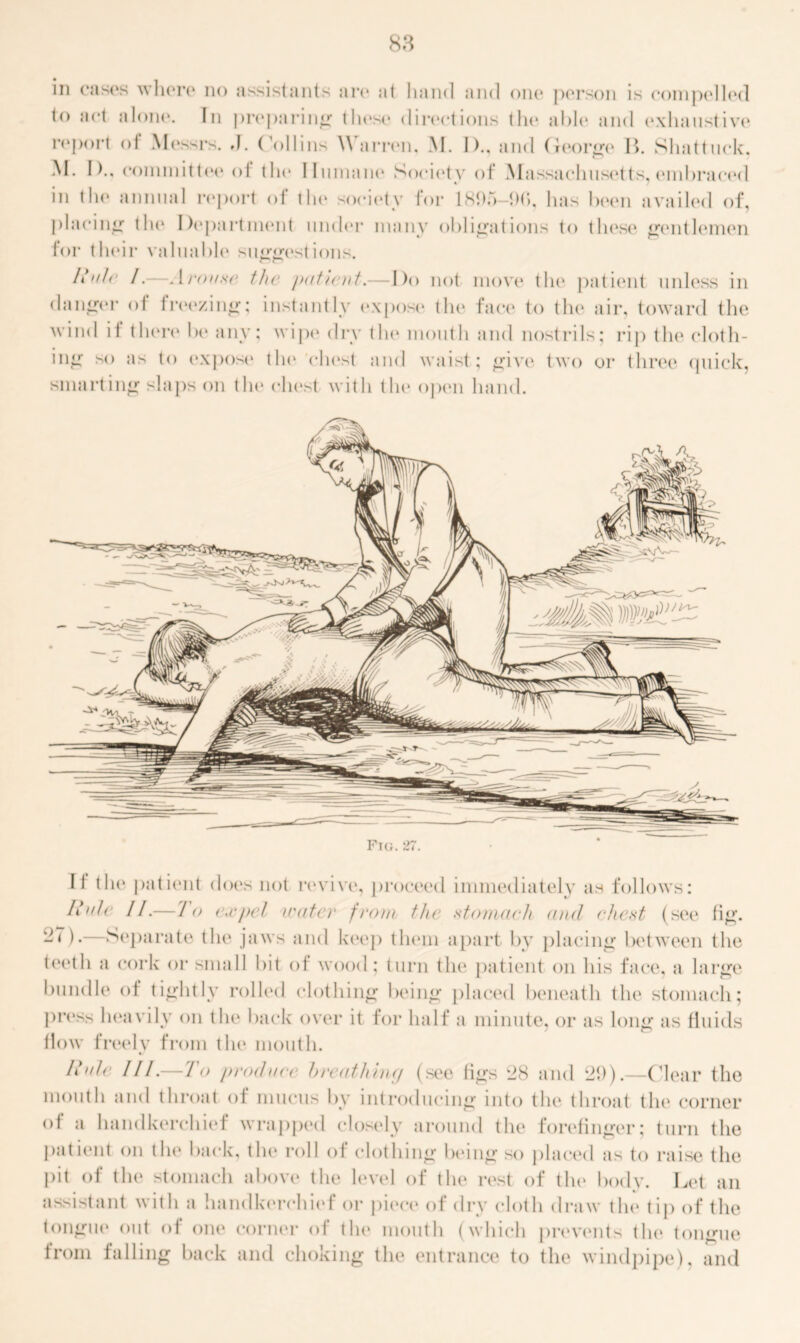 S3 in cases where no assistants are at hand and one person is coin pelted to ‘,(,t ‘done. In preparing these directions tlit* able and exhaustive report of Messrs, d. Collins Warren, M. I)., and George B. Shattuck. M. I)., committee of the Humane Society of Massachusetts, embraced in the annual report of the society for 1895—{)(>, has been availed of, placing the Department under many obligations to these gentlemen for their valuable suggestions. It'ile I.—Arouse the /mtlevt.—I)o not move the patient unless in danger of freezing; instantly expose the face to the air, toward the wind if then* be any; wipe dry the mouth and nostrils; rip the cloth- ing so as to expose the chest and waist; give two or three quick, smarting slaps on the chest with the open hand. II the patient does not revive, proceed immediately as follows: Iiuh II.—To expel >rater from the stomach and chest (see fig. -T)•—Separate the jaws and keep them apart by placing between the teeth a cork or small bit of wood: turn the patient on his face, a large bundle of tightly rolled clothing being placed beneath the stomach; press heavily on the back over it for half a minute, or as long as fluids flow freely from the mouth. II 'ile III.—To produce breath tuff (see figs 28 and 29).—Clear the mouth and throat of mucus by introducing into the throat the* corner of a handkerchief wrapped closely around the forefinger; turn the patient on the back, the roll of clothing being so placed as to raise the pit of the stomach above the level of the rest of the body. Let an assistant with a handkerchief or piece of dry cloth draw the tip of the tongue out of one corner of the mouth (which prevents the tongue from falling back and choking the entrance to the windpipe), and