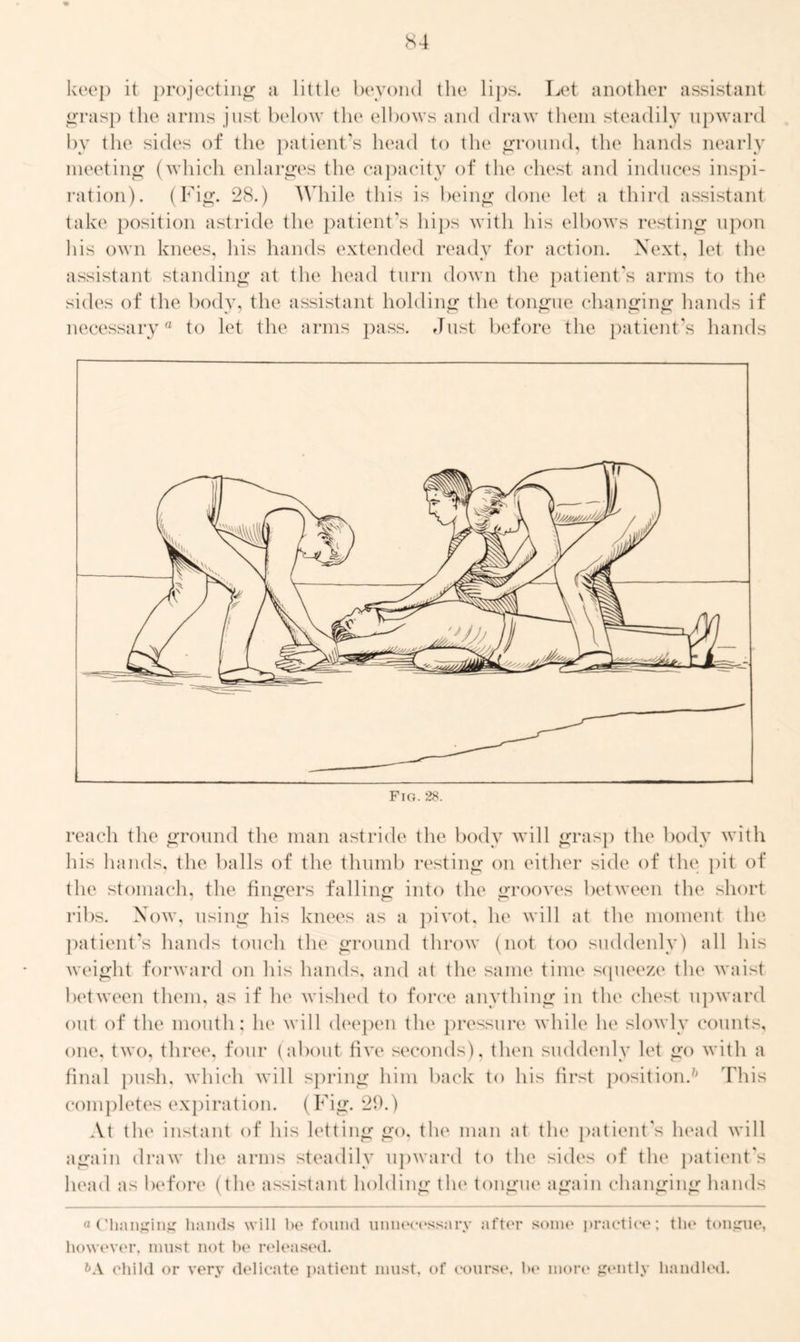 keep it projecting a little beyond the lips. Let another assistant grasp the arms just below the elbows and draw them steadily upward by the sides of the patient's head to the ground, the hands nearly meeting (which enlarges the capacity of the chest and induces inspi- ration). (Fig. 28.) While this is being done let a third assistant take position astride the patient’s hips with his elbows resting upon his own knees, his hands extended ready for action. Xext, let the assistant standing at the head turn down the patient’s arms to the sides of the body, the assistant holding the tongue changing hands if necessary® to let the arms pass. Just before the patient’s hands reach the ground the man astride the body will grasp the body with his hands, the balls of the thumb resting on either side of the pit of the stomach, the fingers falling into the grooves between the short ribs. Now, using his knees as a pivot, he will at the moment the patient's hands touch the ground throw (not too suddenly) all his weight forward on his hands, and at the same time squeeze the waist between them, as if he wished to force anything in the chest upward out of the mouth; he will deepen the pressure while he slowly counts, one, two, three, four (about five seconds), then suddenly let go with a final push, which will spring him back to his first position.'' This completes expiration. (Fig. 29.) At the instant of his letting go, the man at the patient's head will again draw the arms steadily upward to the sides of the patient's head as before (the assistant holding the tongue again changing hands a (’hanging hands will he found unnecessary after some practice; the tongue, however, must not be released. &A child or very delicate patient must, of course, be more gently handled.
