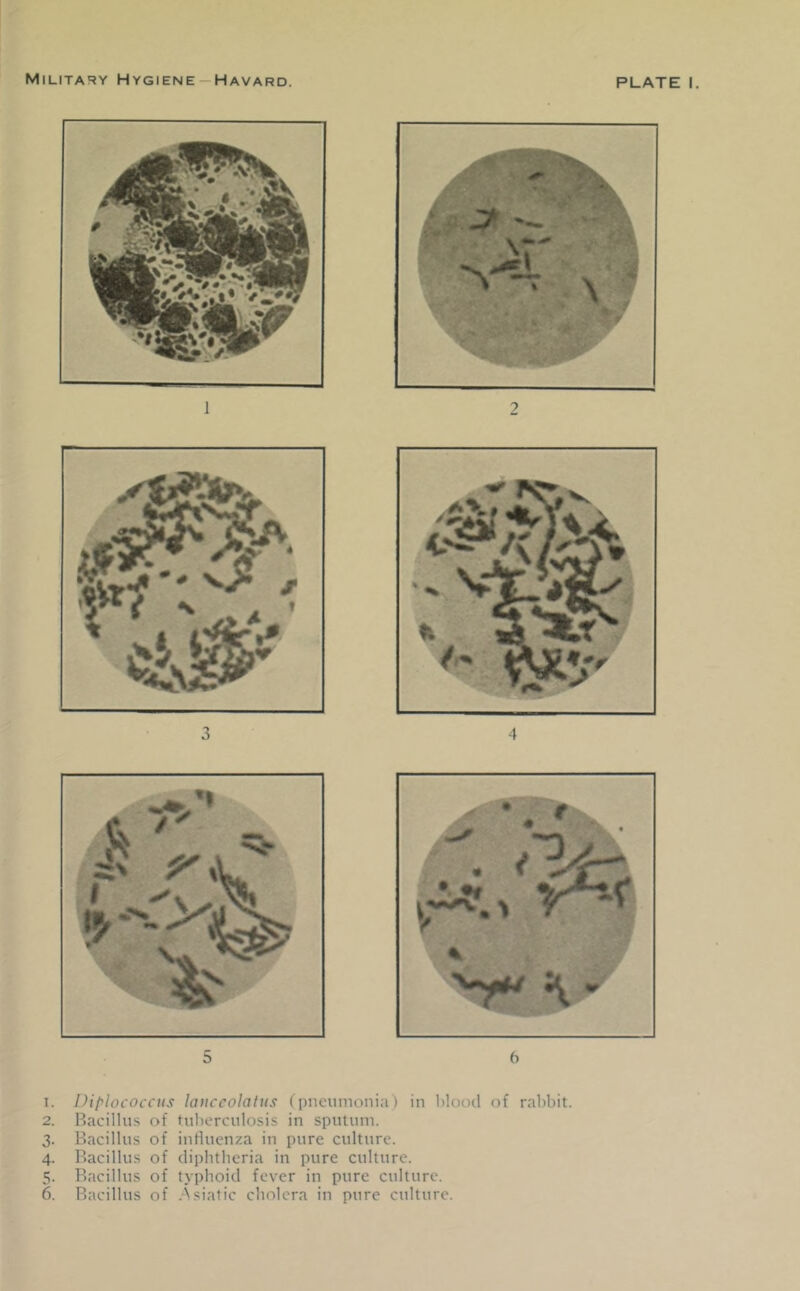 % 5 6 1. Diplococciis lauccolatus (i)iicuinonia) in hlood of rabbit. 2. Hacilliis of tulierculosis in sputum. 3- Bacillus of influenza in pure culture. 4. Bacillus of diphtheria in pure culture. 5. Bacillus of typhoid fever in pure culture. 6. Bacillus of .Asiatic cholera in pure culture.