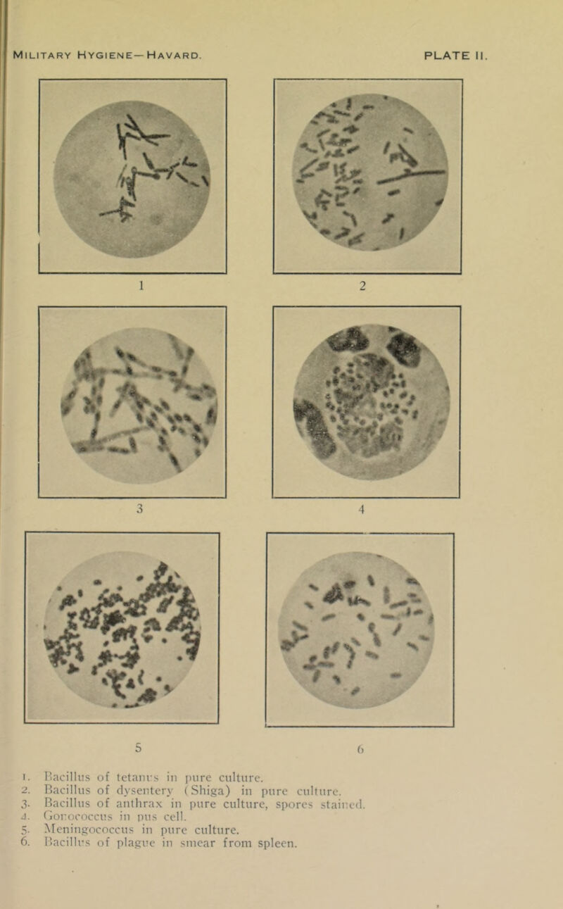 1. Bacillus of tetanus in pure culture. 2. Bacillus of dysentery (Shiga) in pure culture. 3- Bacillus of anthrax in pure culture, spores stair.ed. 4. Gonococcus in pus cell. Meningococcus in pure culture. Bacillus of plague in smear from spleen.