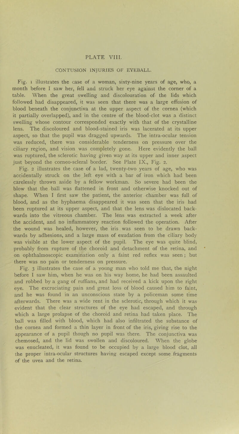 CONTUSION INJURIES OF EYEBALL. Fig. 1 illustrates the case of a woman, sixty-nine years of age, who, a month before I saw her, fell and struck her eye against the corner of a table. When the great swelling and discolouration of the lids which followed had disappeared, it was seen that there was a large effusion of blood beneath the conjunctiva at the upper aspect of the cornea (which it partially overlapped), and in the centre of the blood-clot was a distinct swelling whose contour corresponded exactly with that of the crystalline lens. The discoloured and blood-stained iris was lacerated at its upper aspect, so that the pupil was dragged upwards. The intra-ocular tension was reduced, there was considerable tenderness on pressure over the ciliary region, and vision was completely gone. Here evidently the ball was ruptured, the sclerotic having given way at its upper and inner aspect just beyond the comeo-scleral border. See Plate IX., Fig. 2. Fig. 2 illustrates the case of a lad, twenty-two years of age, who was accidentally struck on the left eye with a bar of iron which had been carelessly thrown aside by a fellow workman. So severe had been the blow that the ball was flattened in front and otherwise knocked out of shape. When I first saw the patient, the anterior chamber was full of blood, and as the hyphaema disappeared it was seen that the iris had been ruptured at its upper aspect, and that the lens was dislocated back- wards into the vitreous chamber. The lens was extracted a week after the accident, and no inflammatory reaction followed the operation. After the wound was healed, however, the iris was seen to be drawn back- wards by adhesions, and a large mass of exudation from the ciliary body was visible at the lower aspect of the pupil. The eye was quite blind, probably from rupture of the choroid and detachment of the retina, and on ophthalmoscopic examination only a faint red reflex was seen ; but there was no pain or tenderness on pressure. Fig. 3 illustrates the case of a young man who told me that, the night before I saw him, when he was on his way home, he had been assaulted and robbed by a gang of ruffians, and had received a kick upon the right eye. The excruciating pain and great loss of blood caused him to faint, and he was found in an unconscious state by a policeman some time afterwards. There was a wide rent in the sclerotic, through which it was evident that the clear structures of the eye had escaped, and through which a large prolapse of the choroid and retina had taken place. The ball was filled with blood, which had also infiltrated the substance of the cornea and formed a thin layer in front of the iris, giving rise to the appearance of a pupil though no pupil was there. The conjunctiva was chemosed, and the lid was swollen and discoloured. When the globe was enucleated, it was found to be occupied by a large blood clot, all the proper intra-ocular structures having escaped except some fragments of the uvea and the retina.