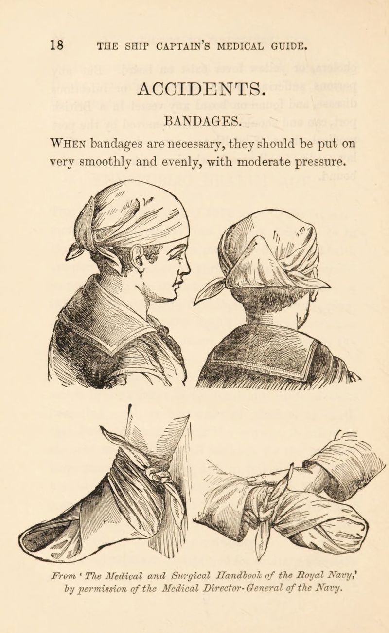 ACCIDENTS. BANDAGES. When bandages are necessary, they should be put on very smoothly and evenly, with moderate pressure. From ‘ The Medical and Surgical ITandhooh of the limjal Navy,^ hy g^crmission of the Medical Director-General of the Navy.