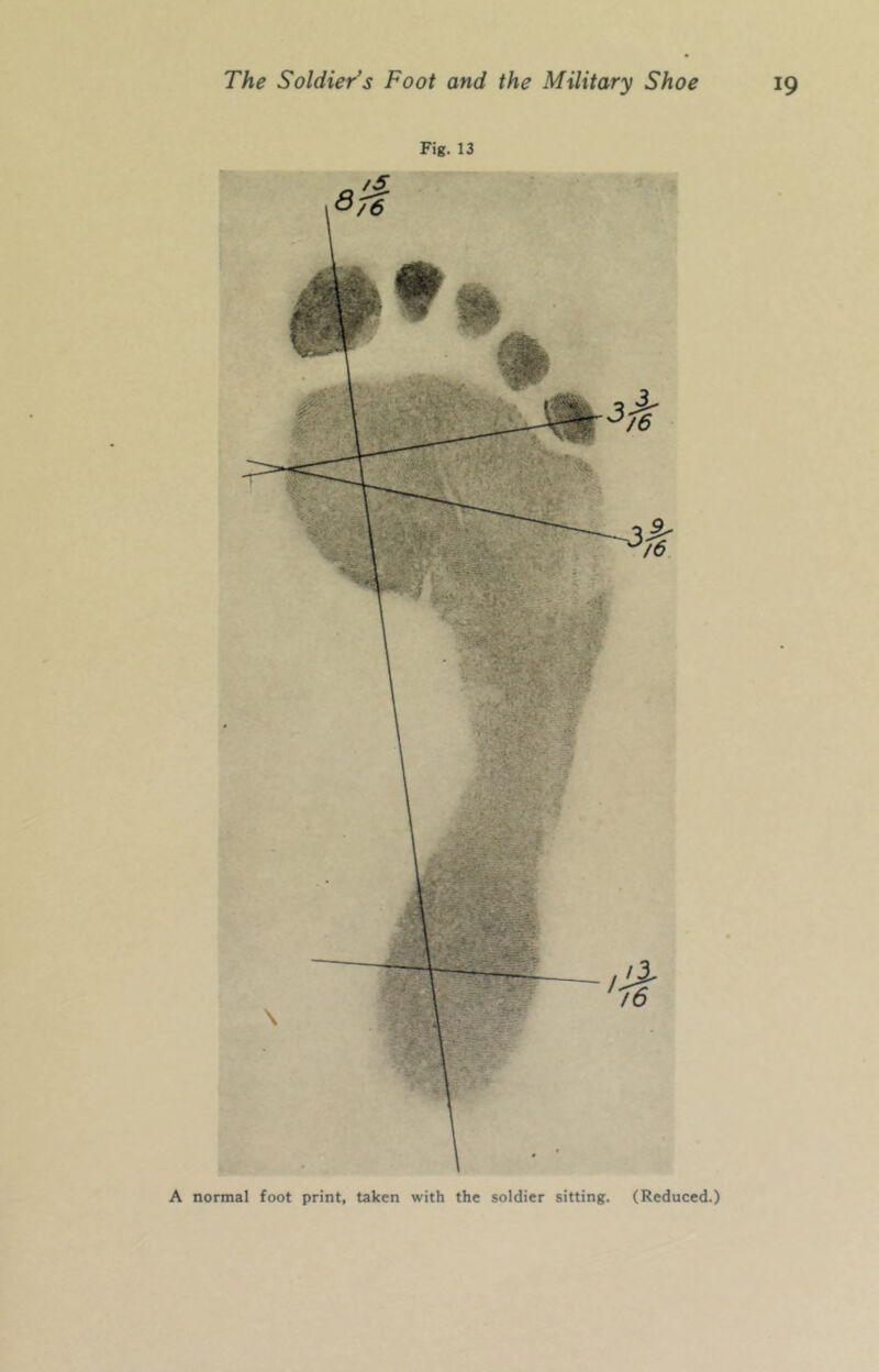 Fig. 13 A normal foot print, taken with the soldier sitting. (Reduced.)