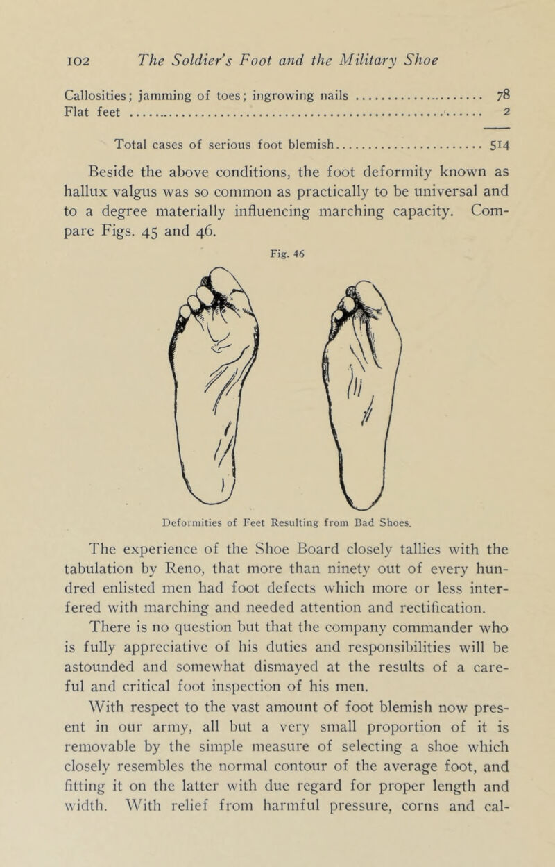 Callosities; jamming of toes; ingrowing nails 78 Flat feet ■ 2 Total cases of serious foot blemish 514 Beside the above conditions, the foot deformity known as hallux valgus was so common as practically to be universal and to a degree materially influencing marching capacity. Com- pare Figs. 45 and 46. Fig. 46 The experience of the Shoe Board closely tallies with the tabulation by Reno, that more than ninety out of every hun- dred enlisted men had foot defects which more or less inter- fered with marching and needed attention and rectification. There is no question but that the company commander who is fully appreciative of his duties and responsibilities will be astounded and somewhat dismayed at the results of a care- ful and critical foot inspection of his men. With respect to the vast amount of foot blemish now pres- ent in our army, all but a very small proportion of it is removable by the simple measure of selecting a shoe which closely resembles the normal contour of the average foot, and fitting it on the latter with due regard for proper length and width. With relief from harmful pressure, corns and cal-